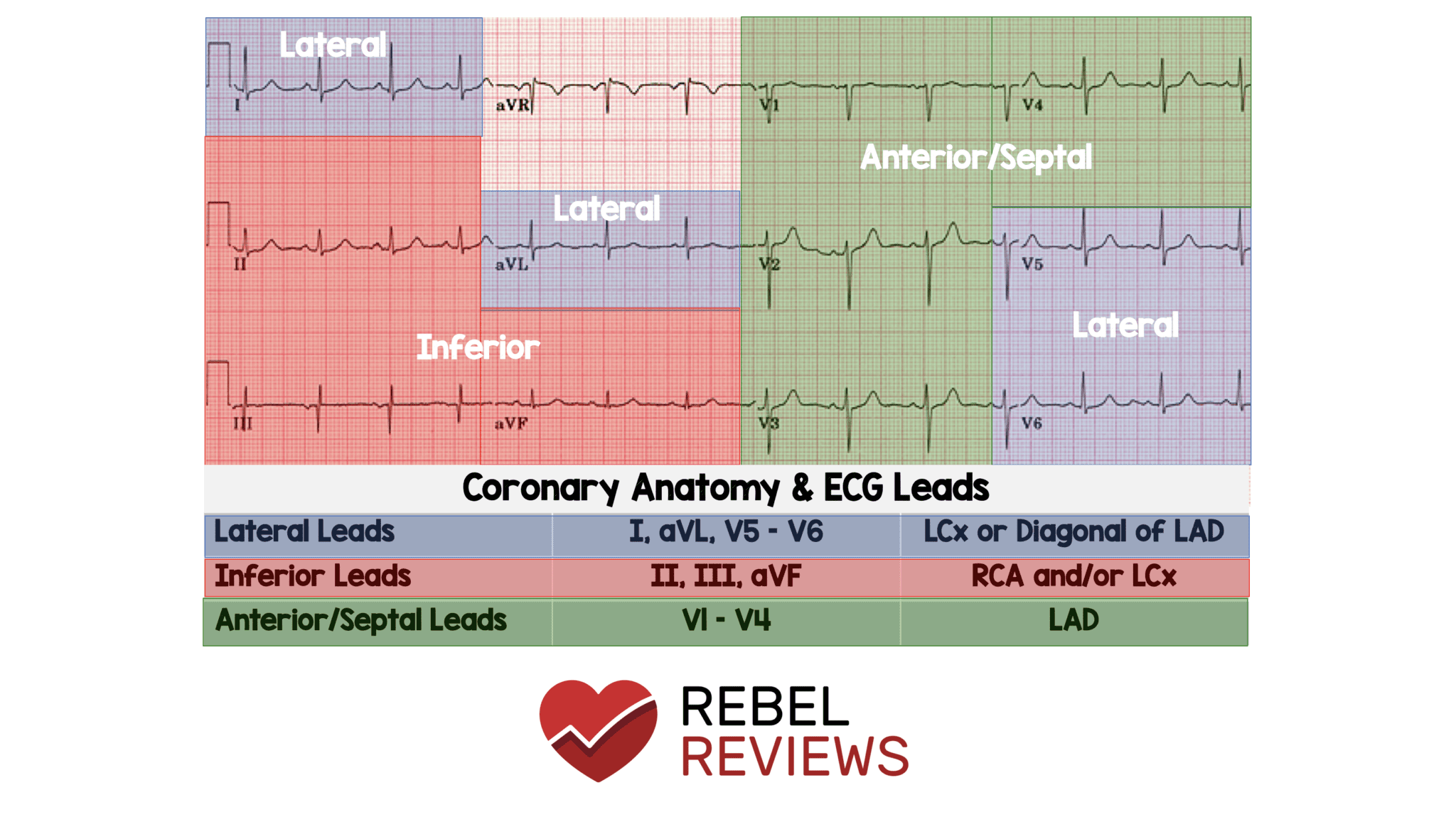 12 Lead Ecg Interpretation
