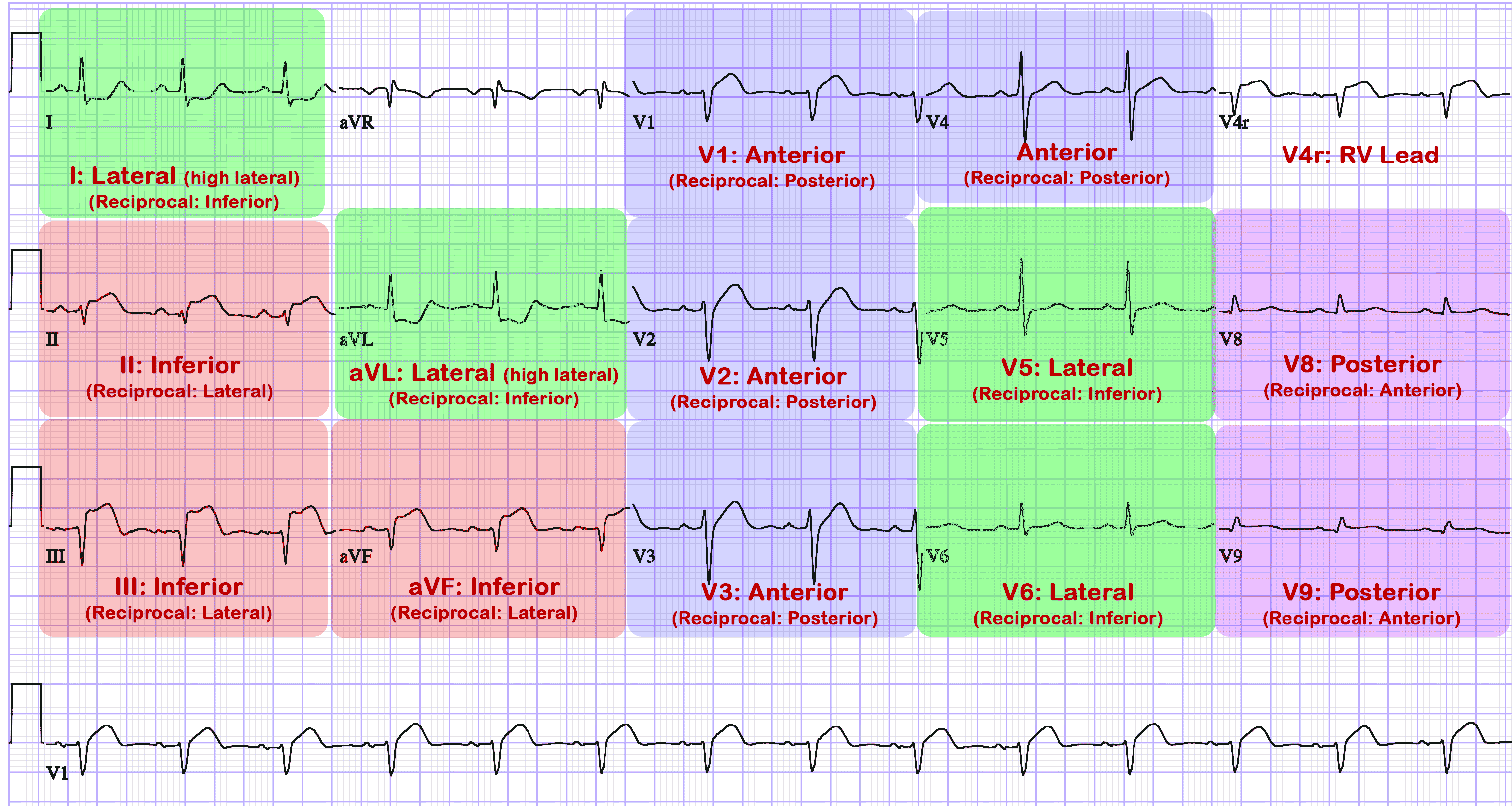 12 Lead Ecg Locations