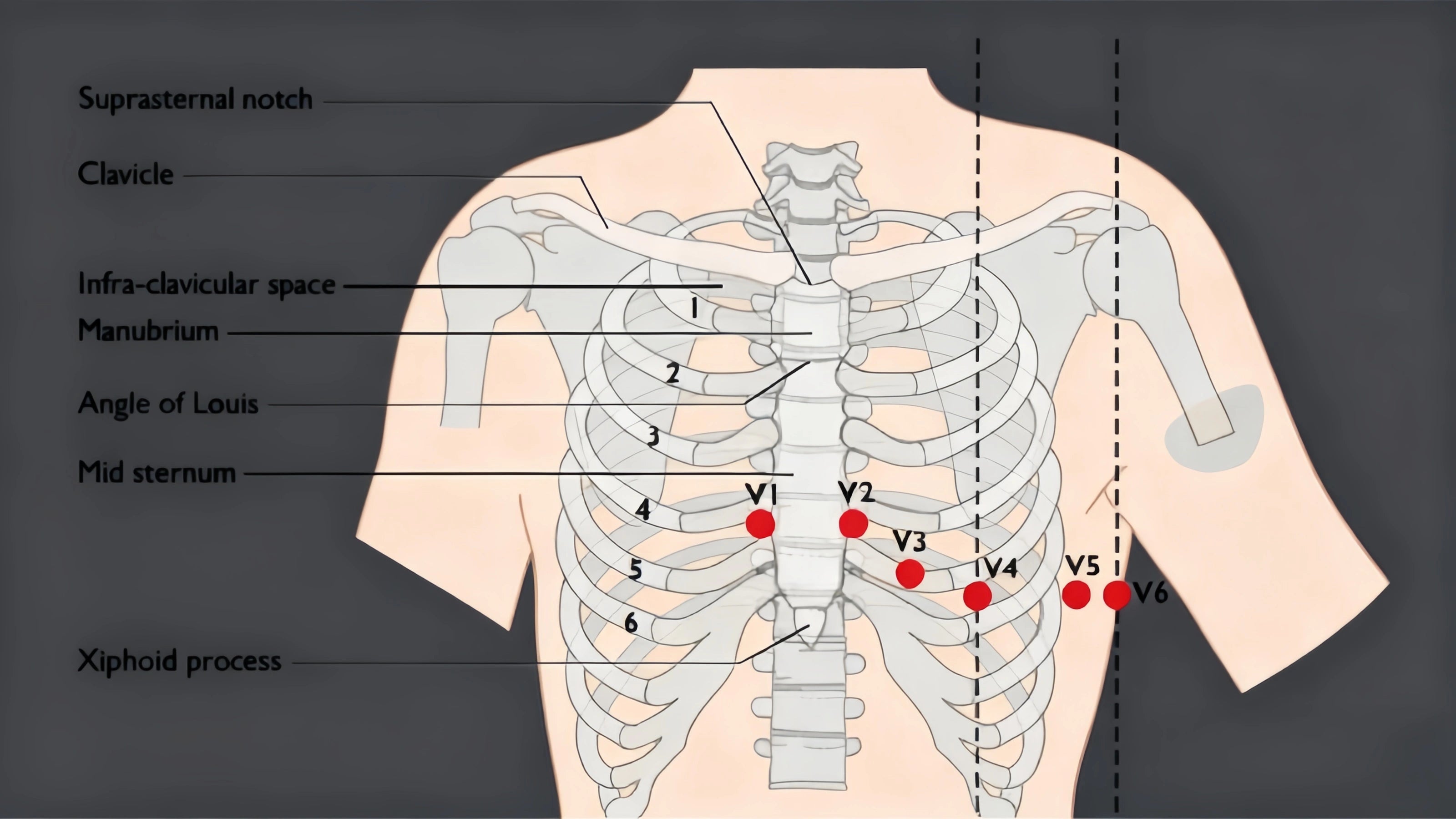 12 Lead Ekg Placement