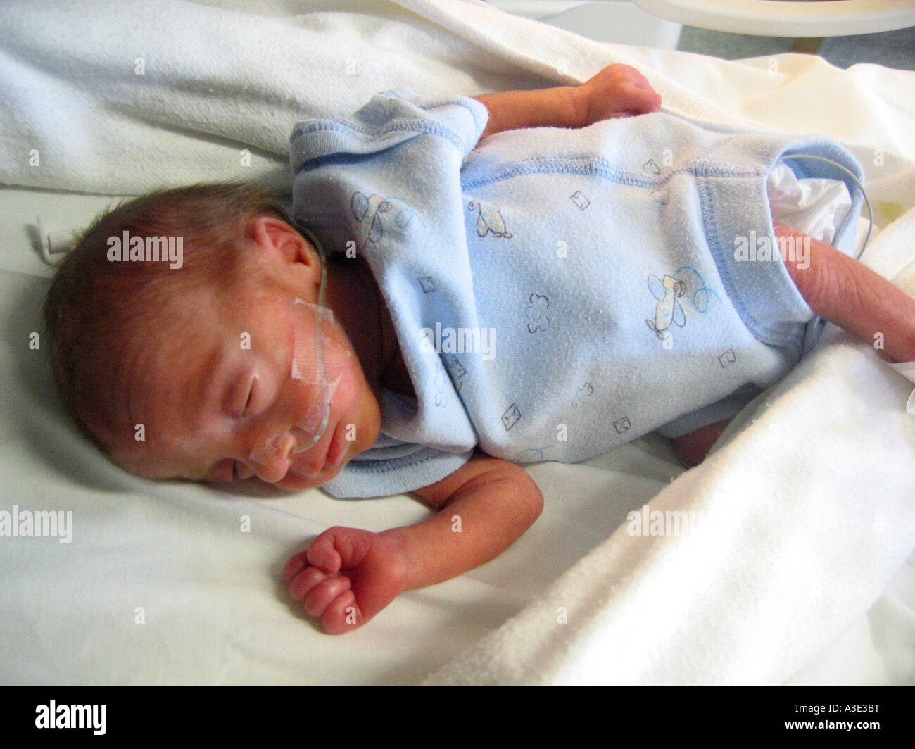 28 Weeks Fetus Born