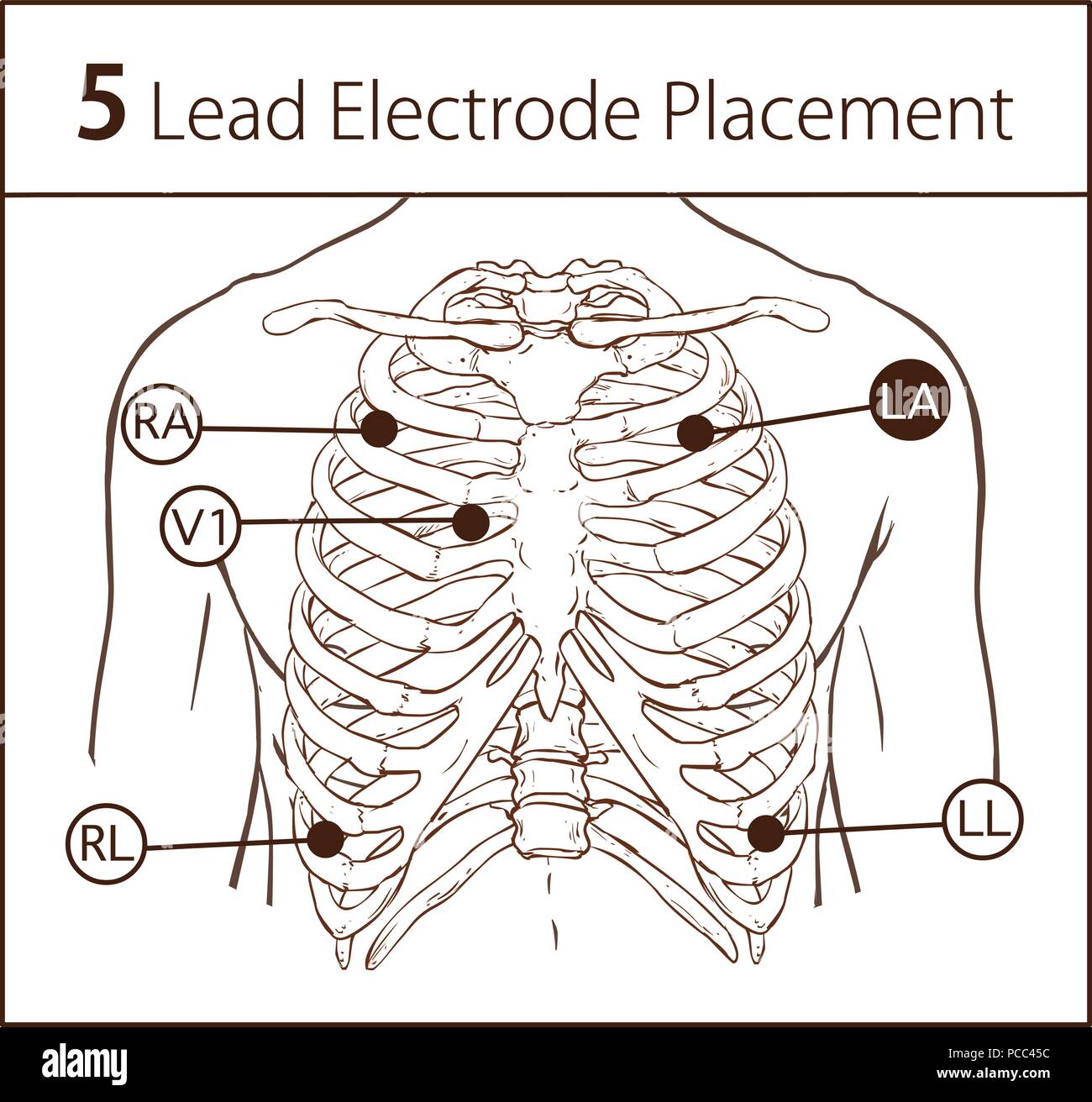 5 Lead Ecg Placement