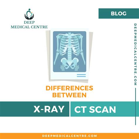 7 Differences Between X Ray And CT Scan - Deep Medical Centre - Face ...