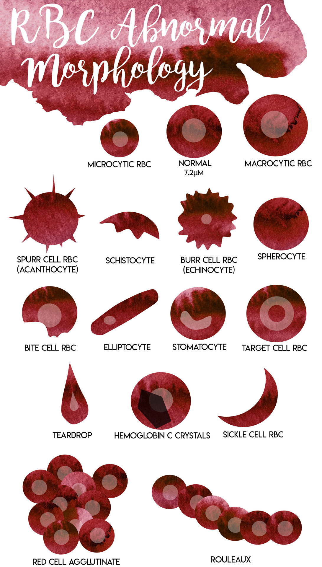 Abnormal Blood Morphology