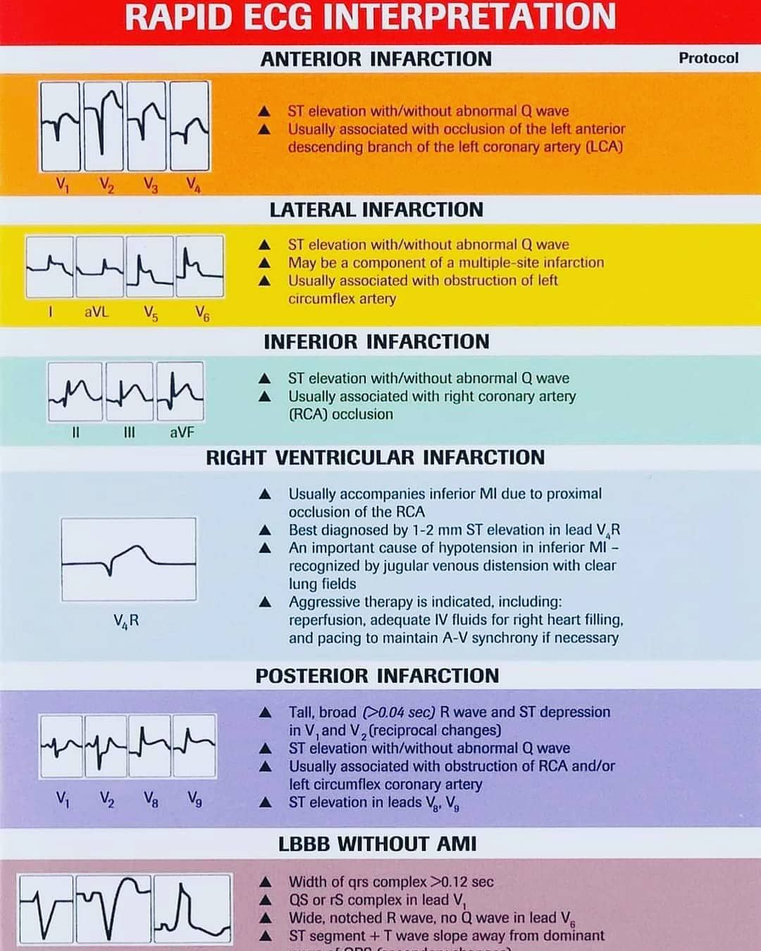 Abnormal In Ecg