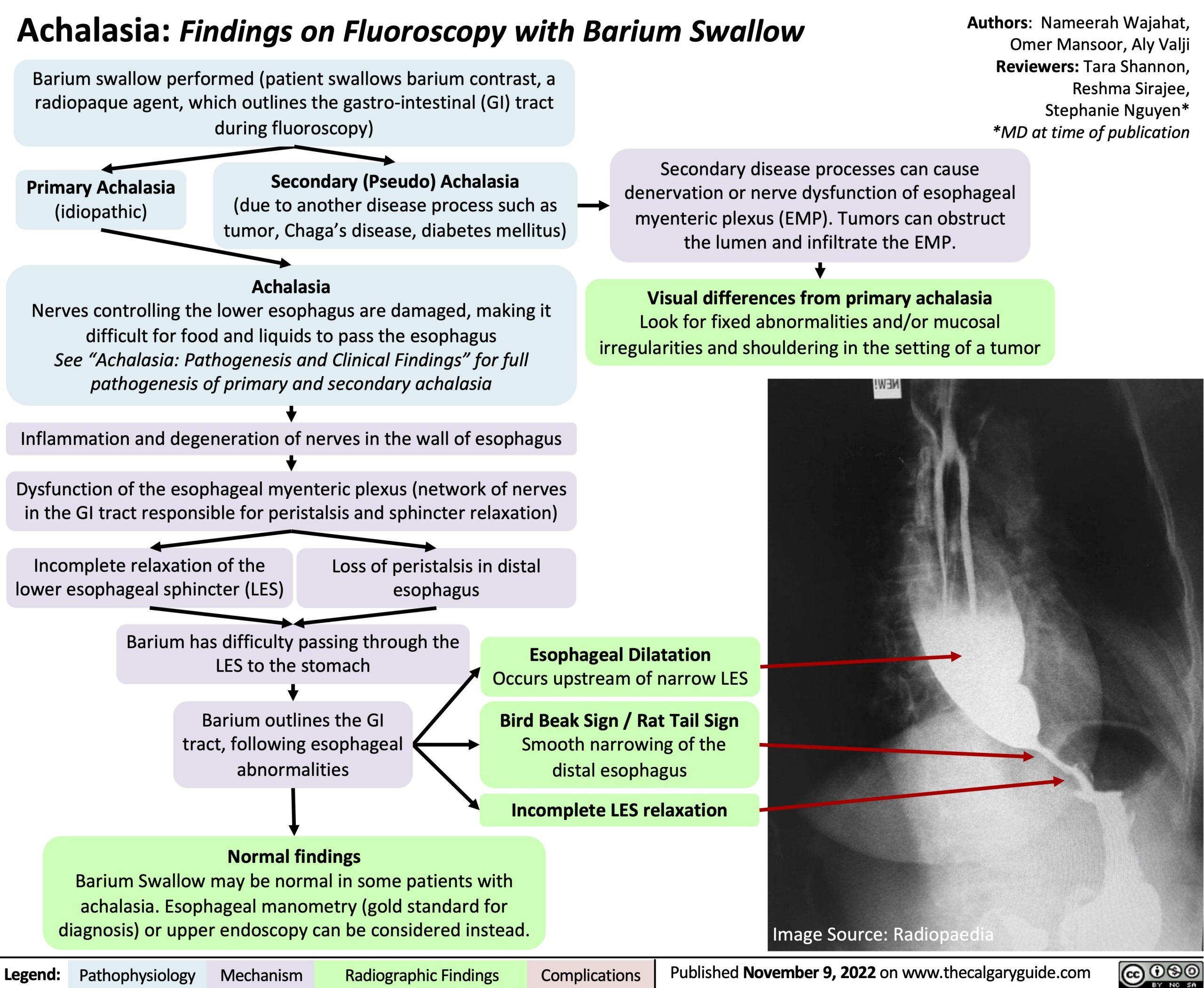 Achalasia Barium Swallow