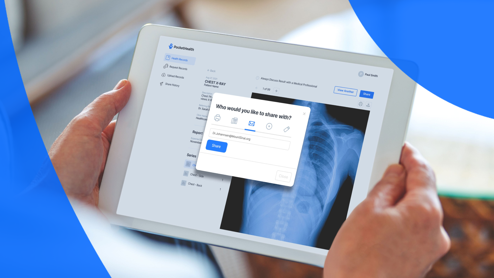 Acute Osseous Abnormality