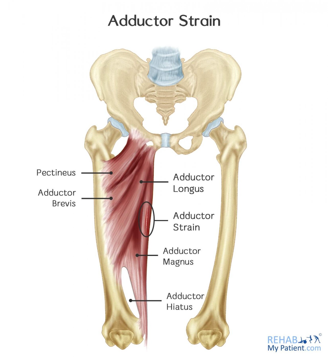 Adductor Muscle Pain