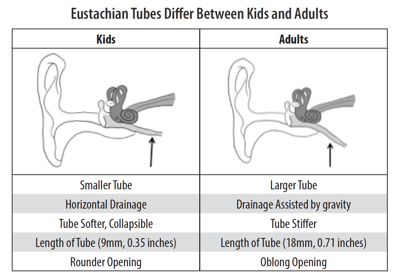 Adult Tubes Ears