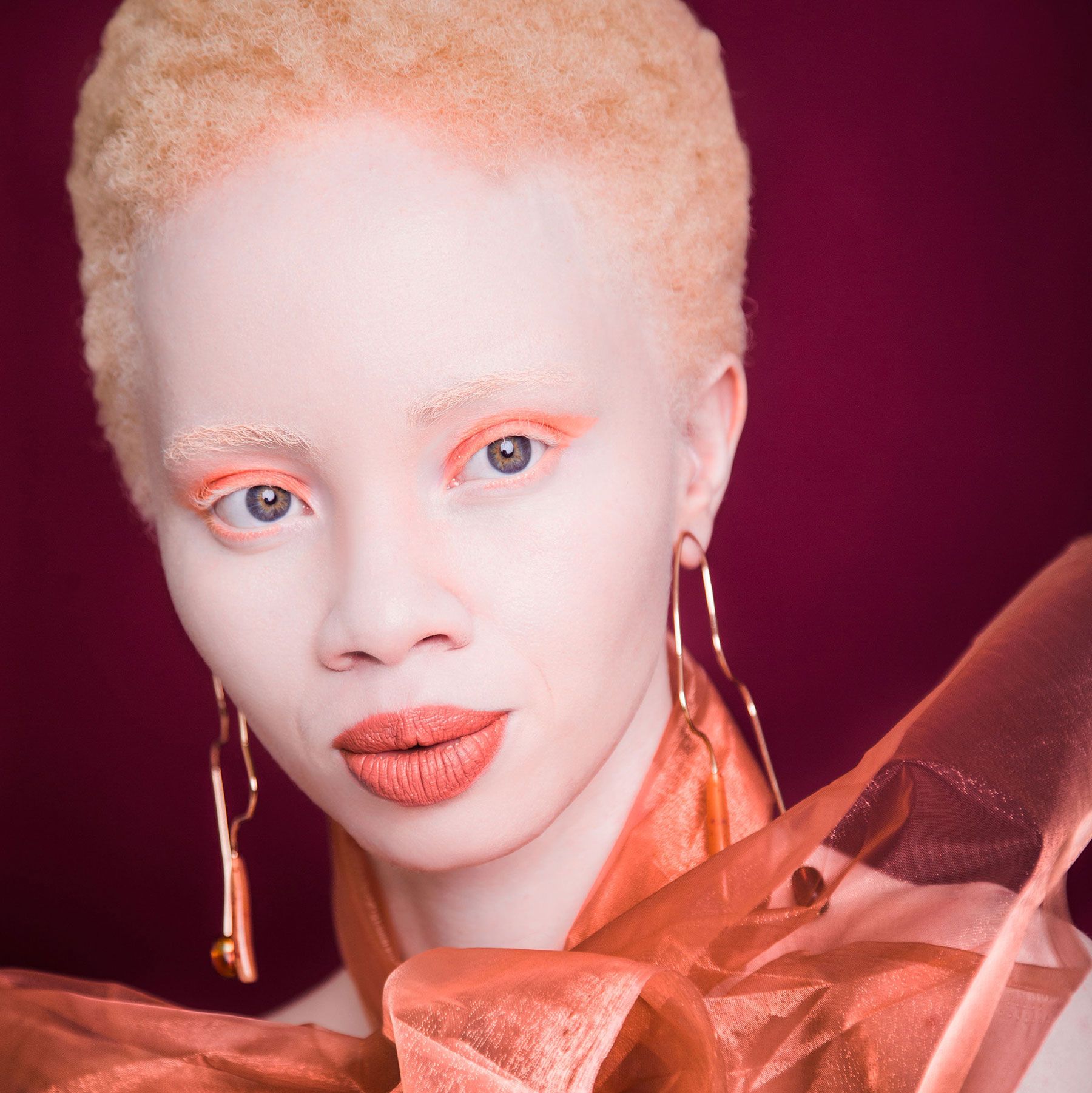Albino Black Person