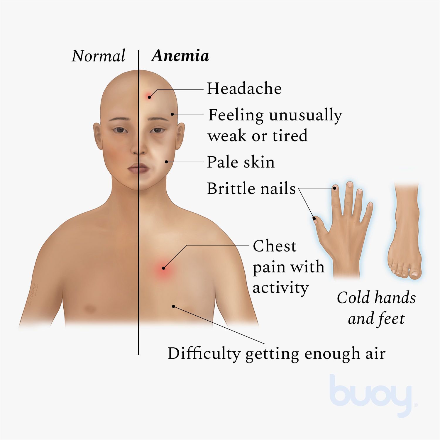 Anemic Skin Rash