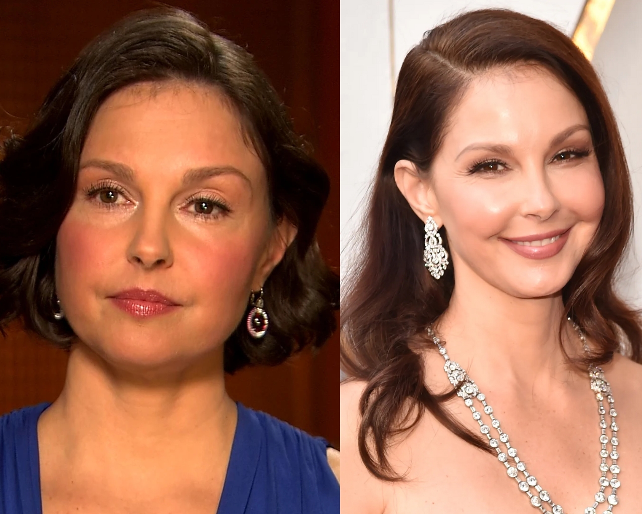 Ashley Judd Face Surgeries