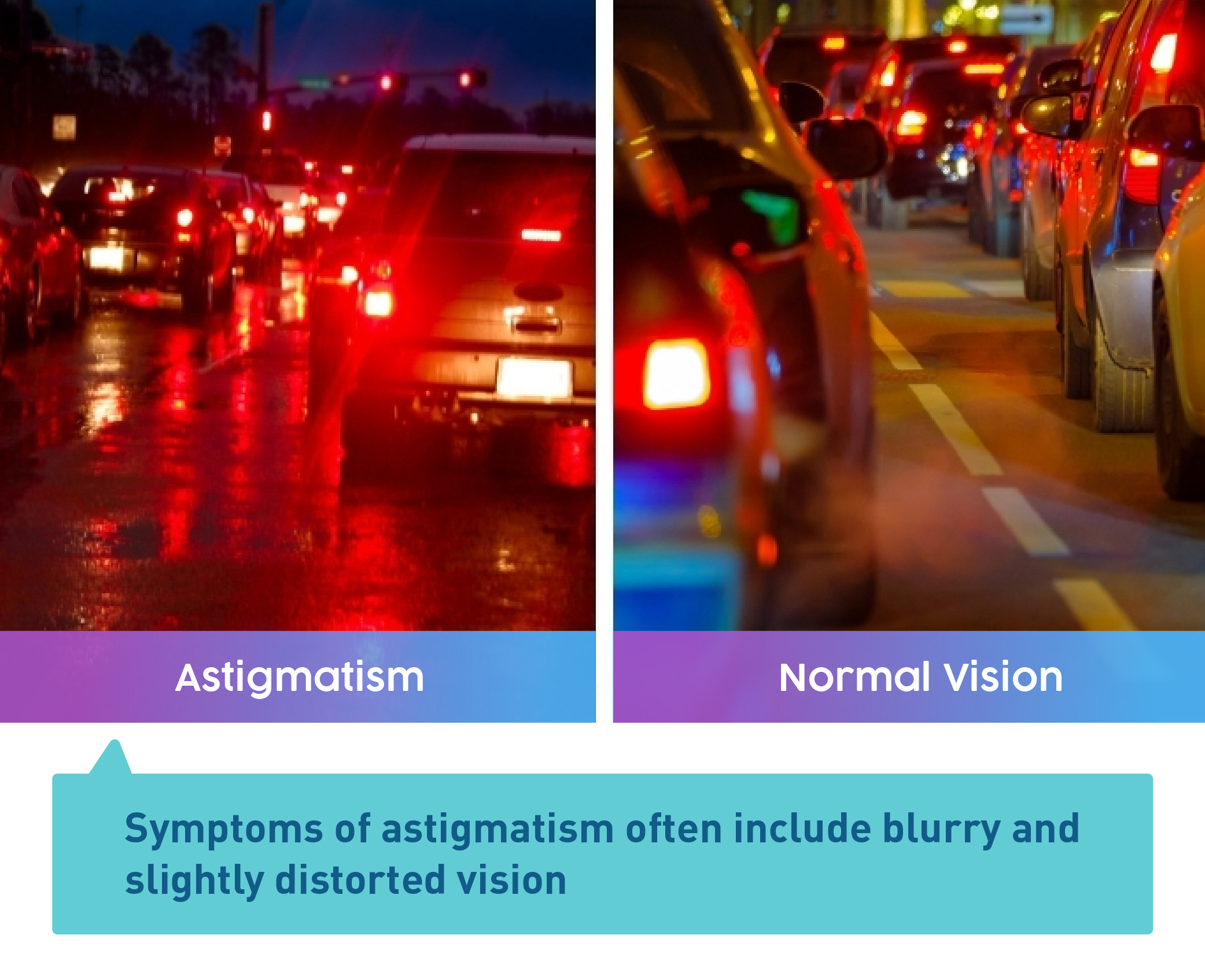 Astigmatism Vs Normal