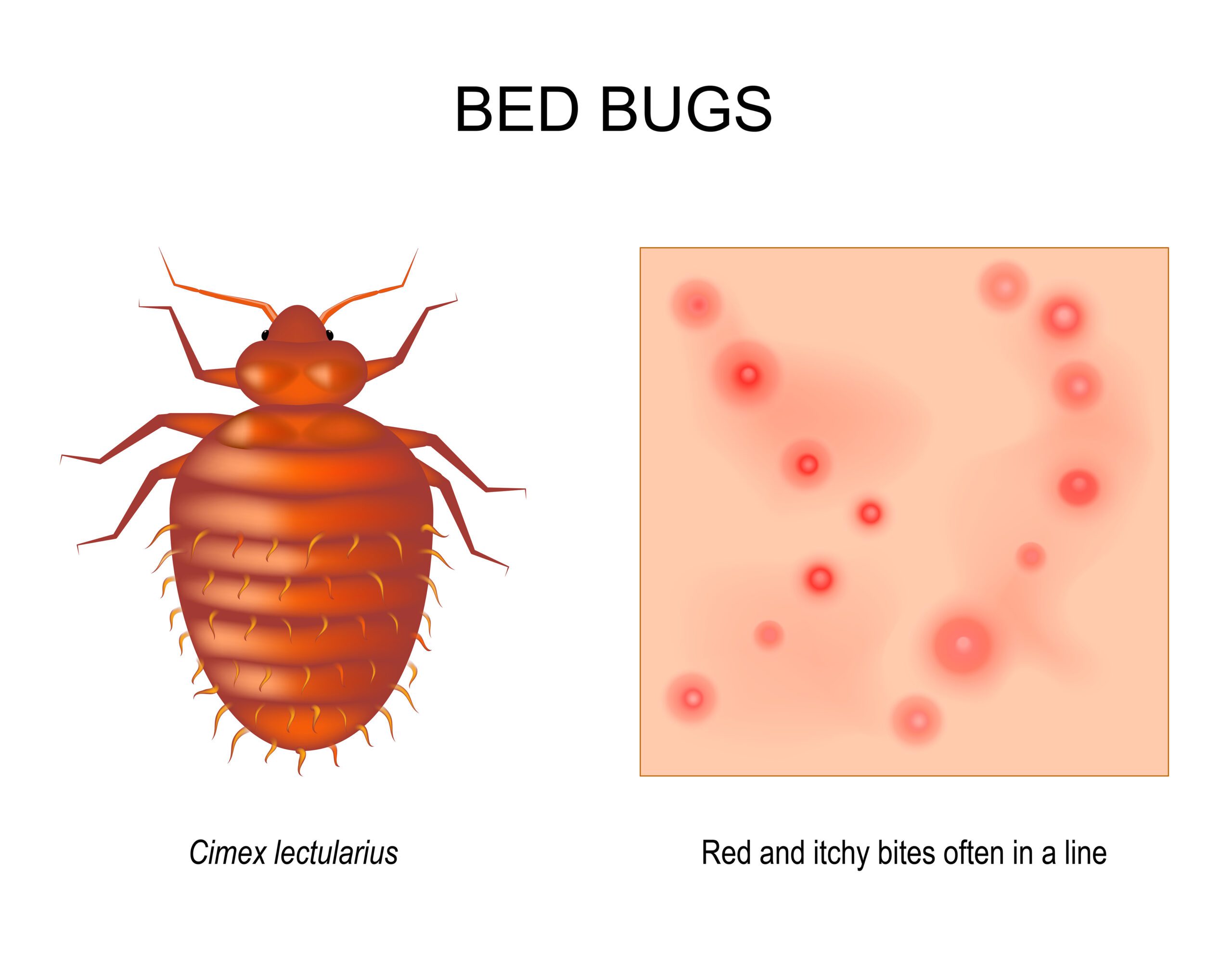 Bed Bug Ant Bites