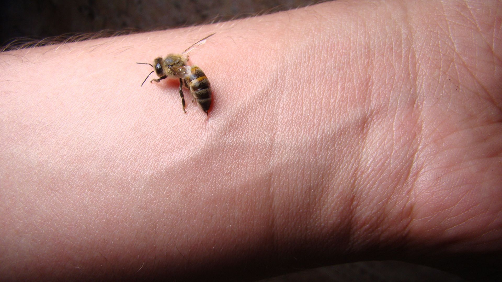 Bee Sting Do They Die