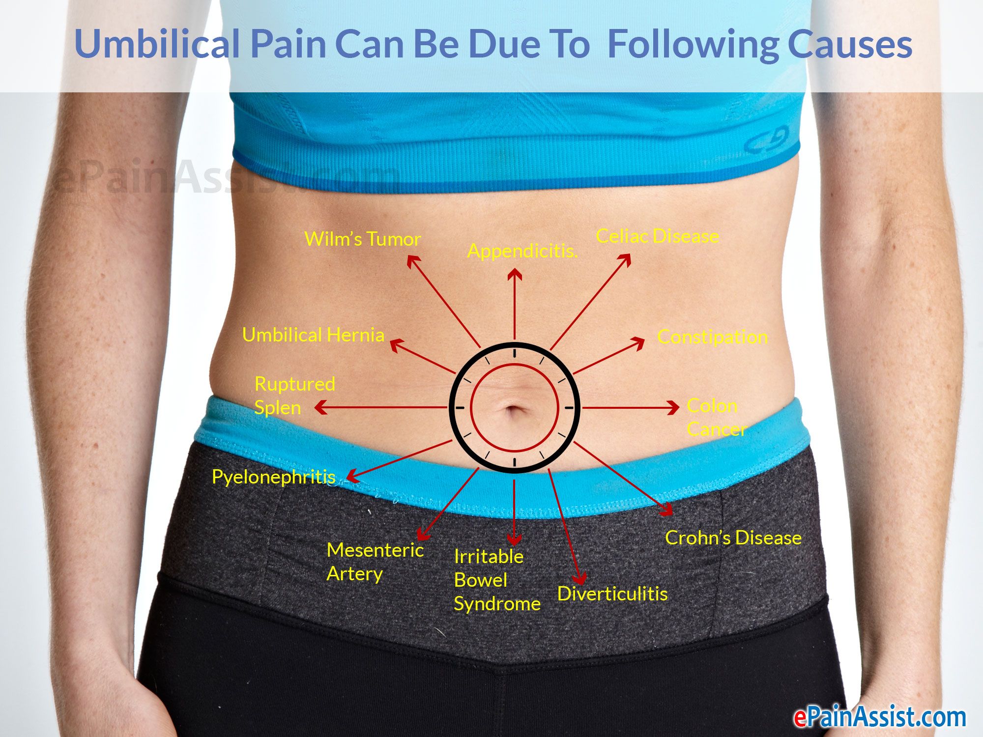 Belly Pain Around Navel