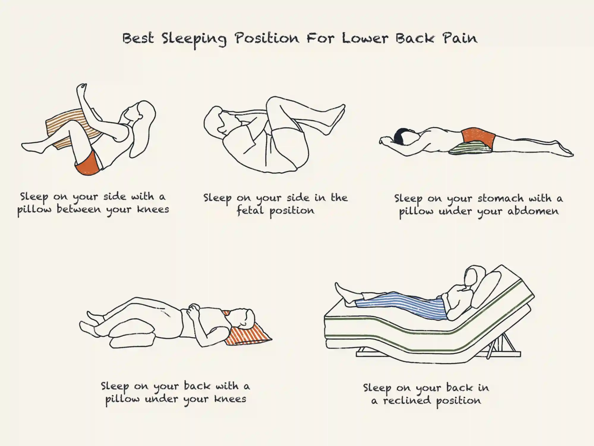 Best Sleep Position For Sciatica