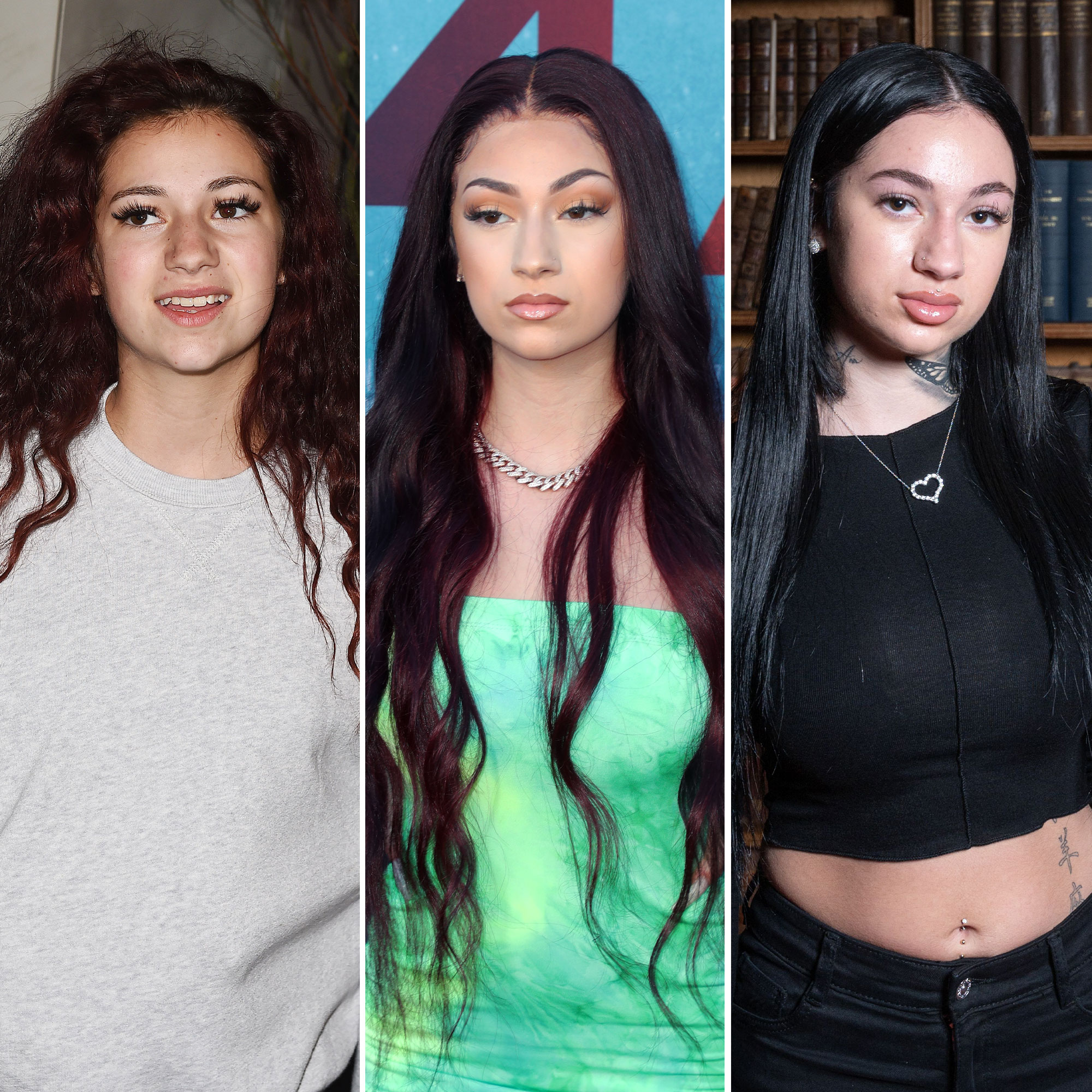 Bhad Bhabie Face Surgery