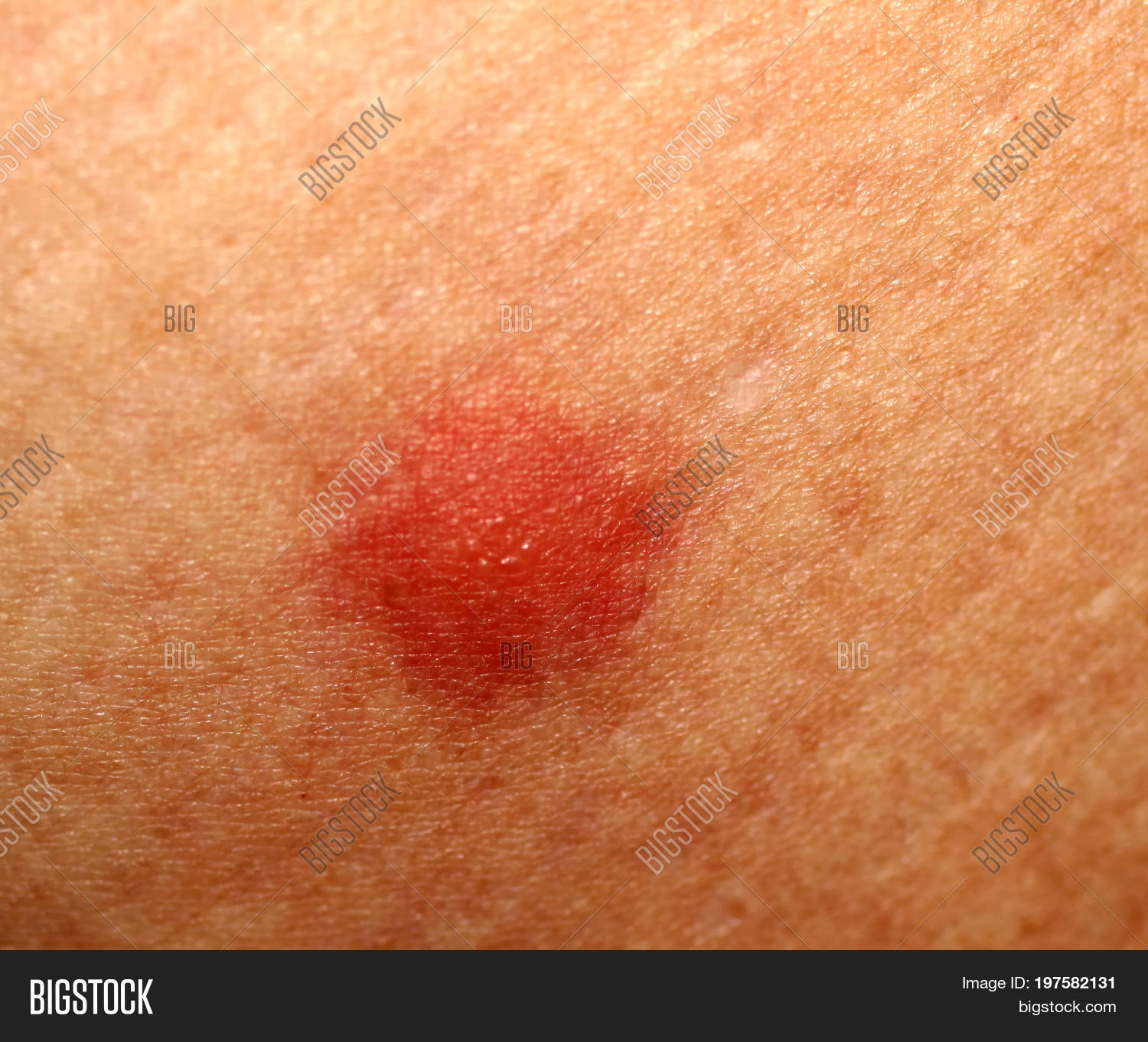 Biggest Boobs Onlyfans