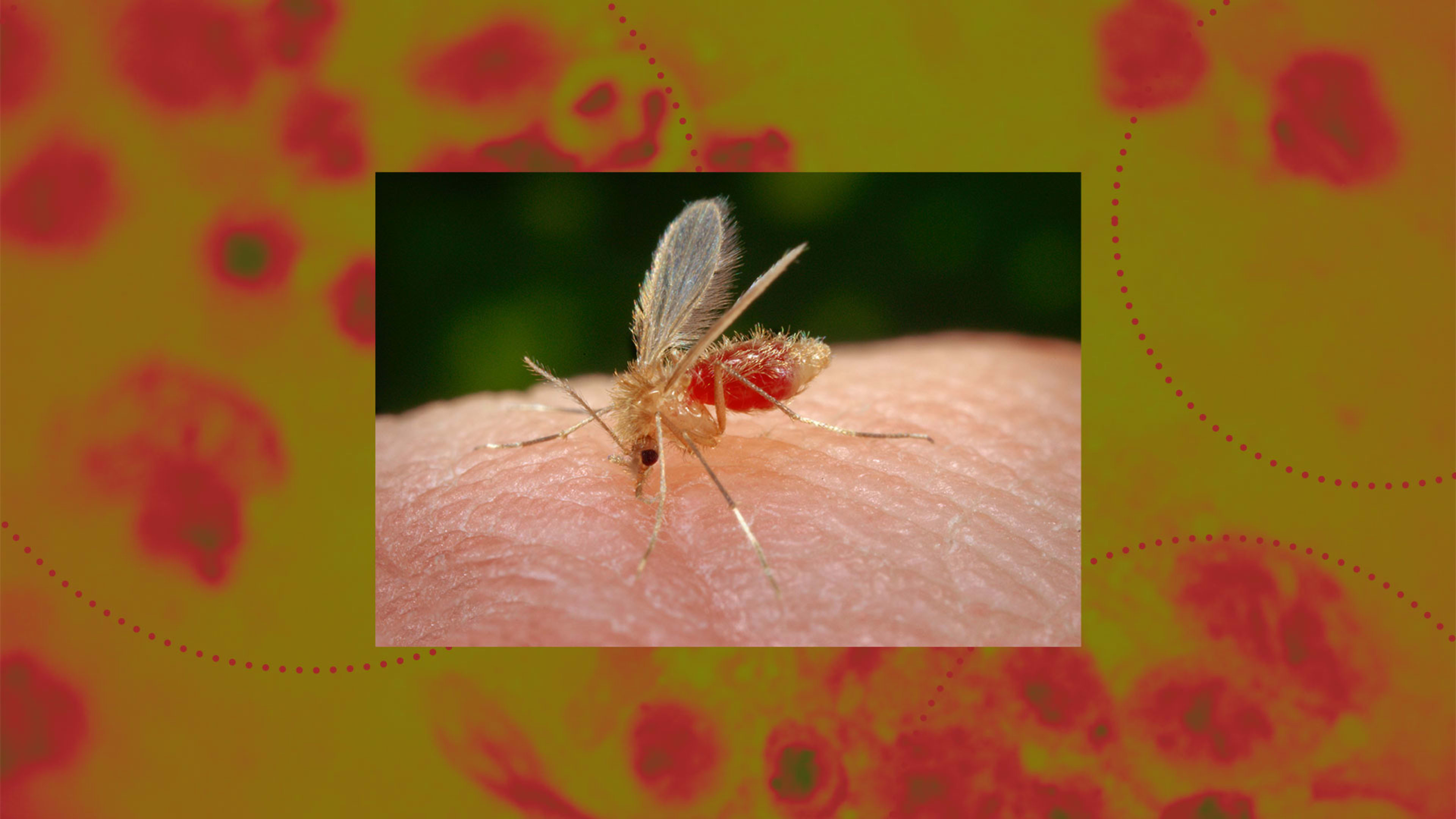 Bites From Sand Flies