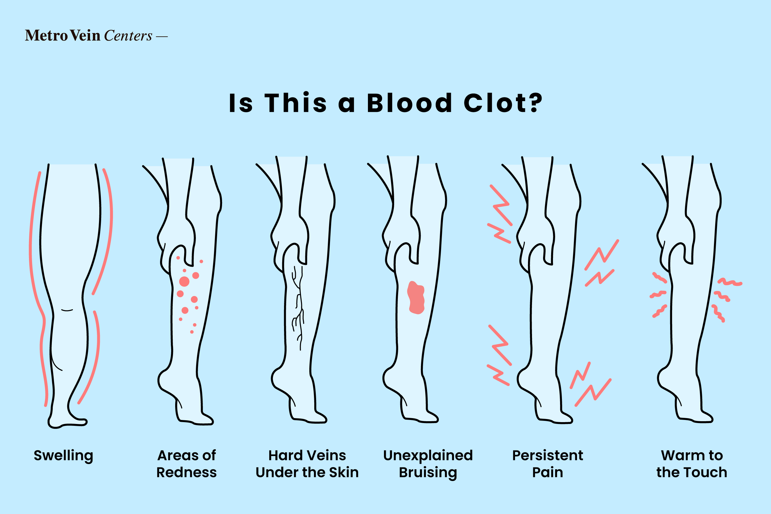 Blood Clot In Foot
