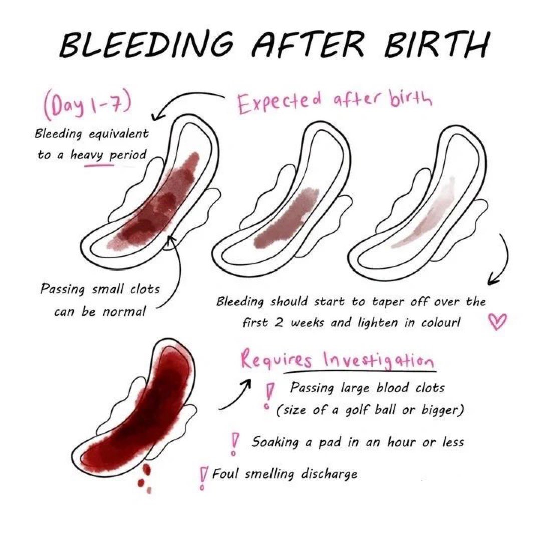 Blood Clots After Labor
