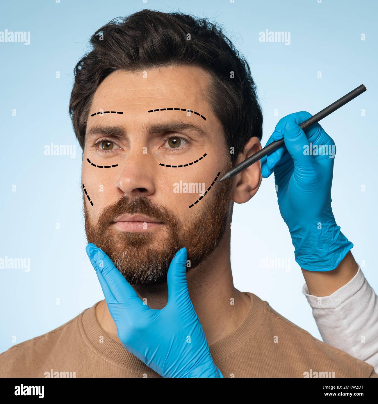 Blue Face Surgery