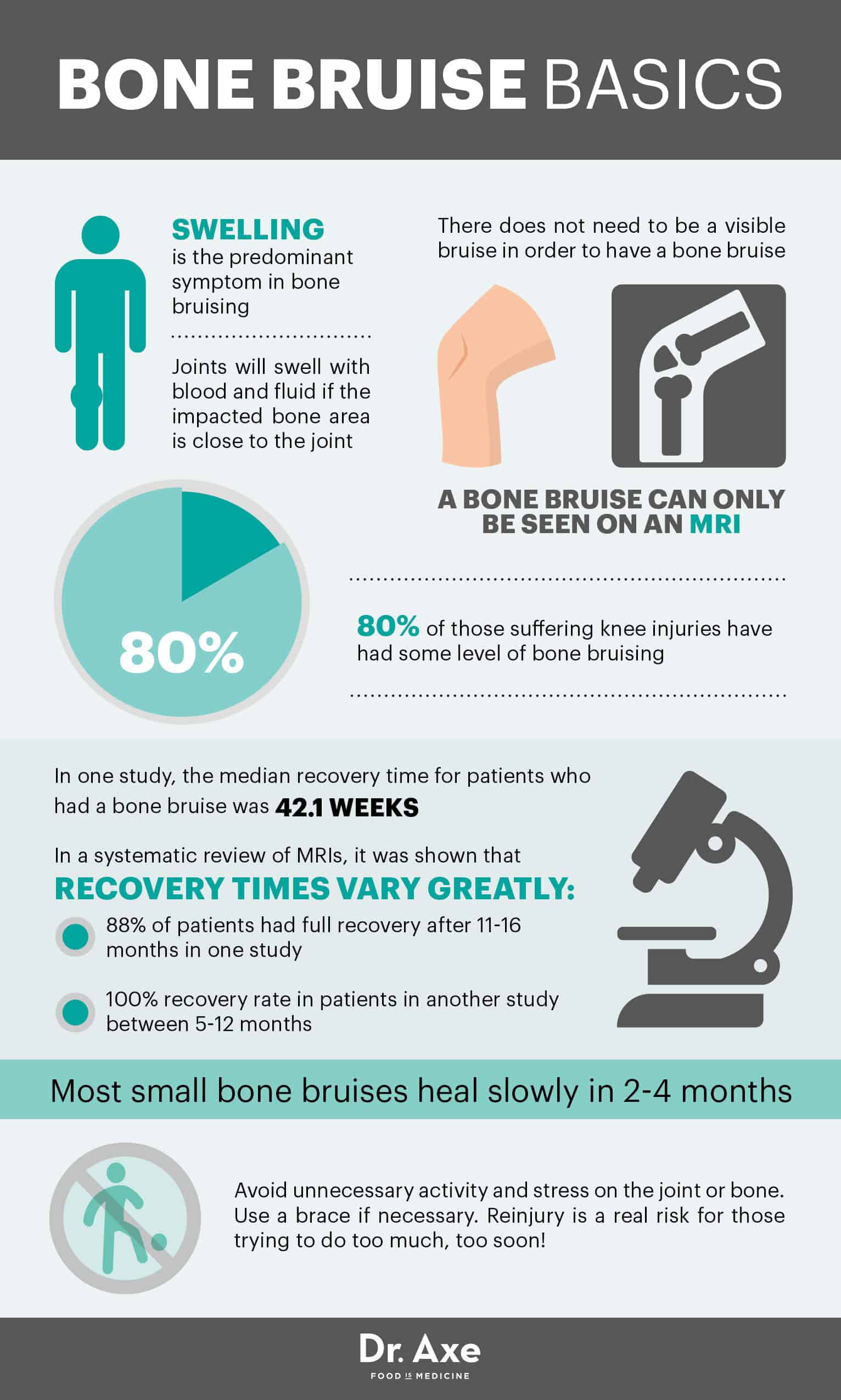 Bone Bruise Healing Time