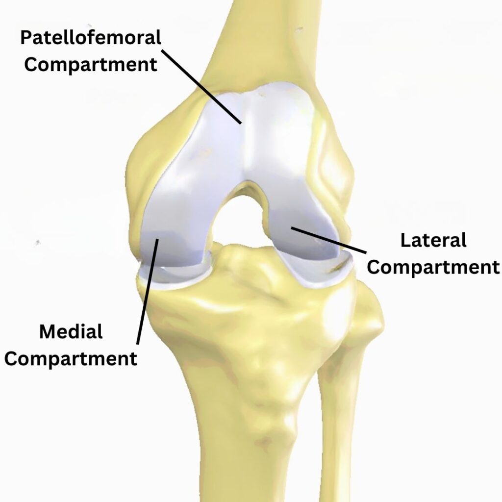 Bone On Bone Knee Pain
