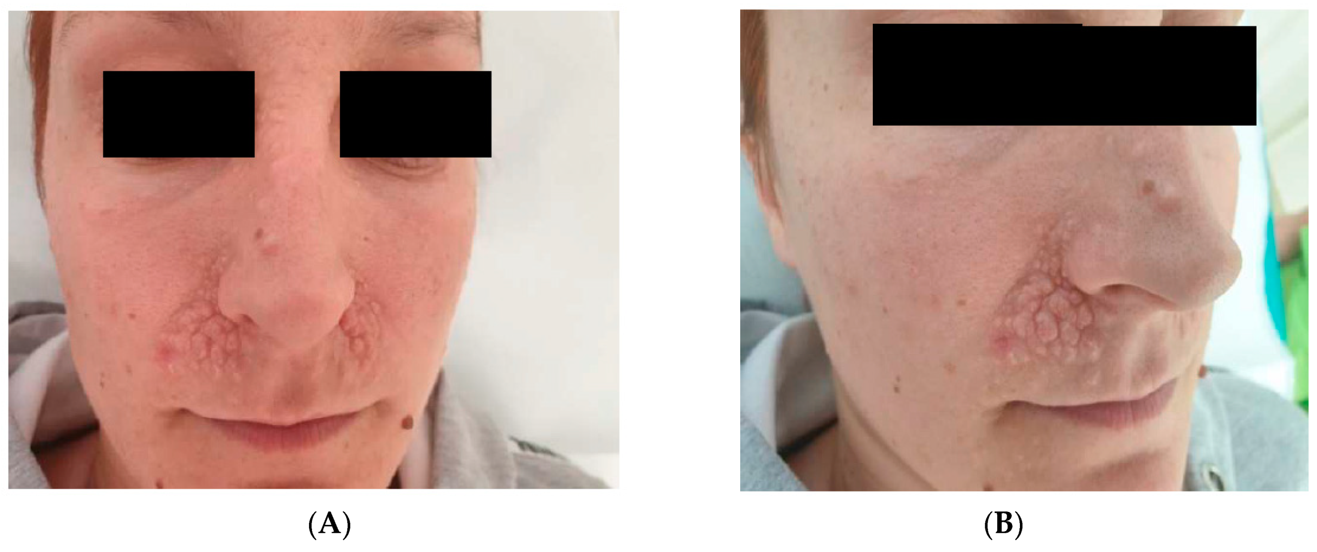 Brooke Shields Playboy Nudes