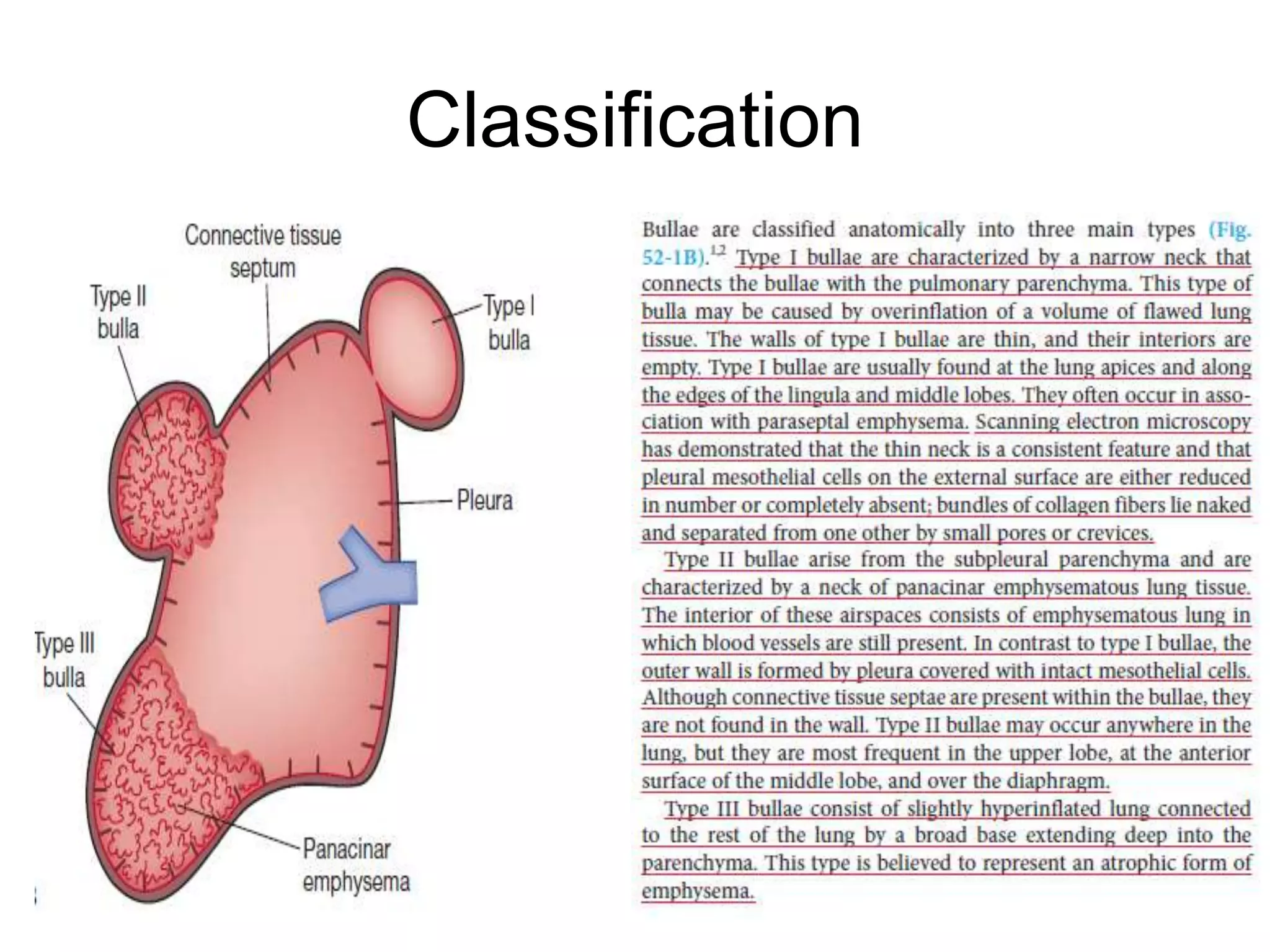 Bullous Lung Disease
