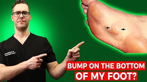 Bump On Bottom Of Foot