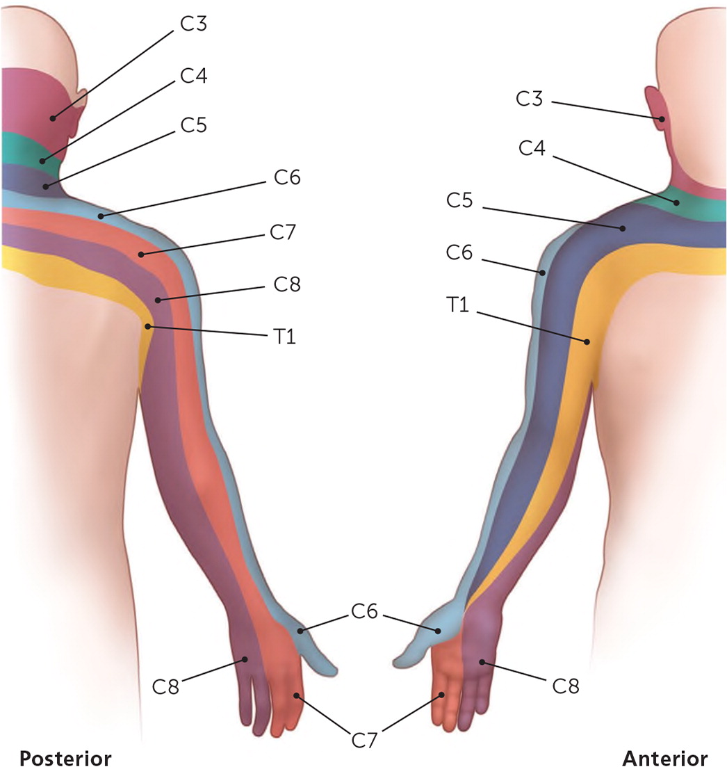C6c7 Nerve Root Compression Symptoms