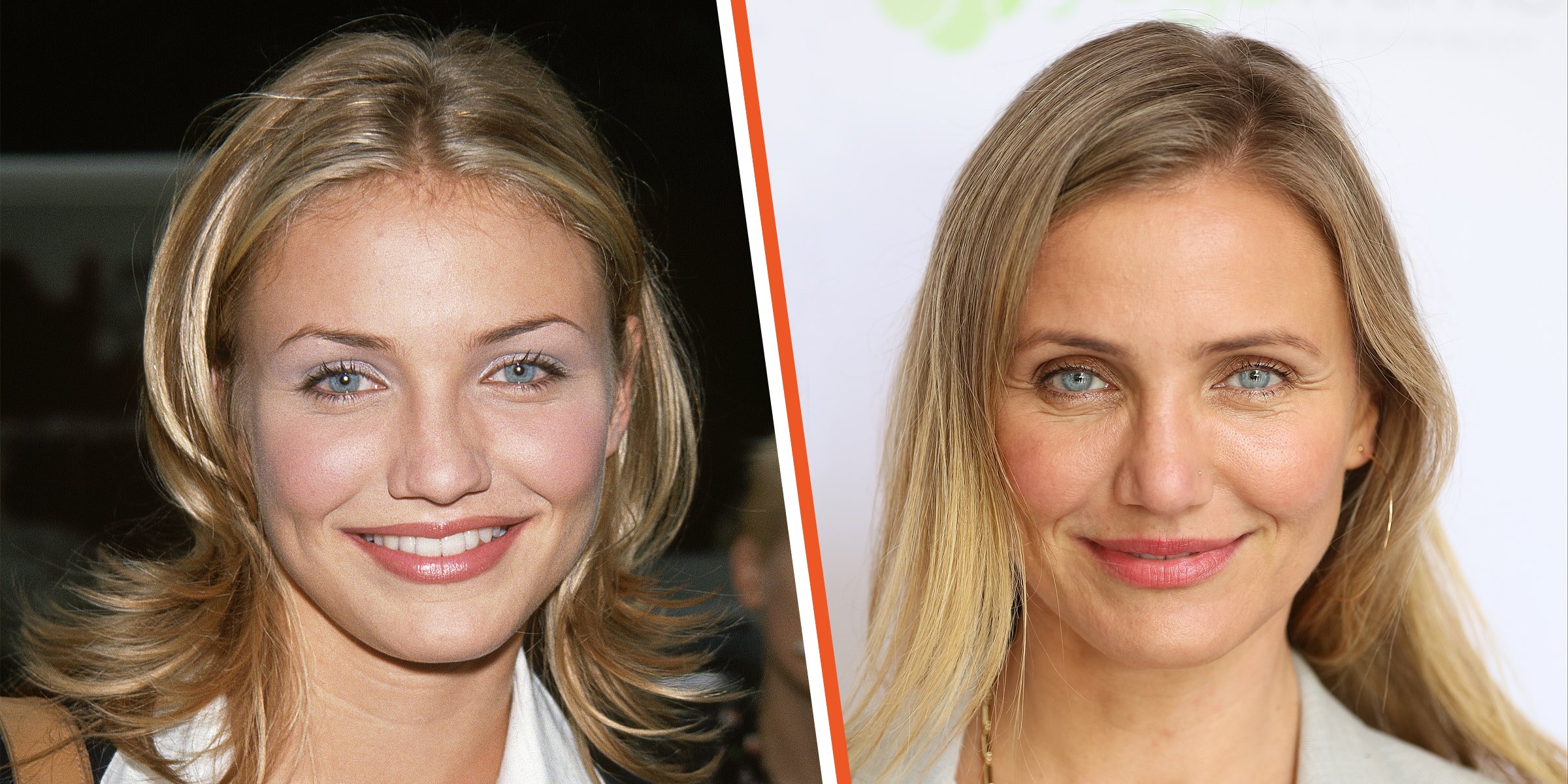 Cameron Diaz Face Surgery