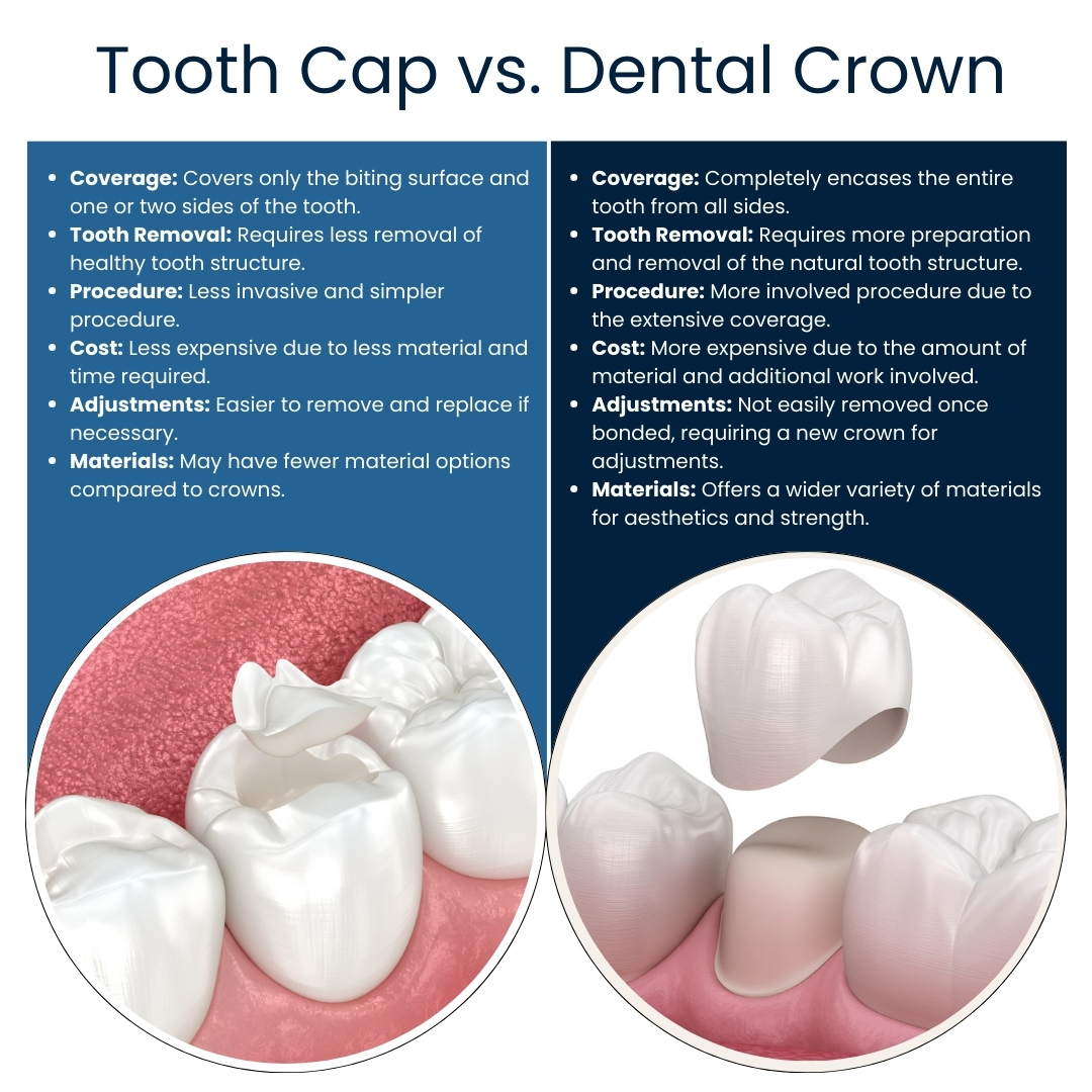 Caps On Teeth