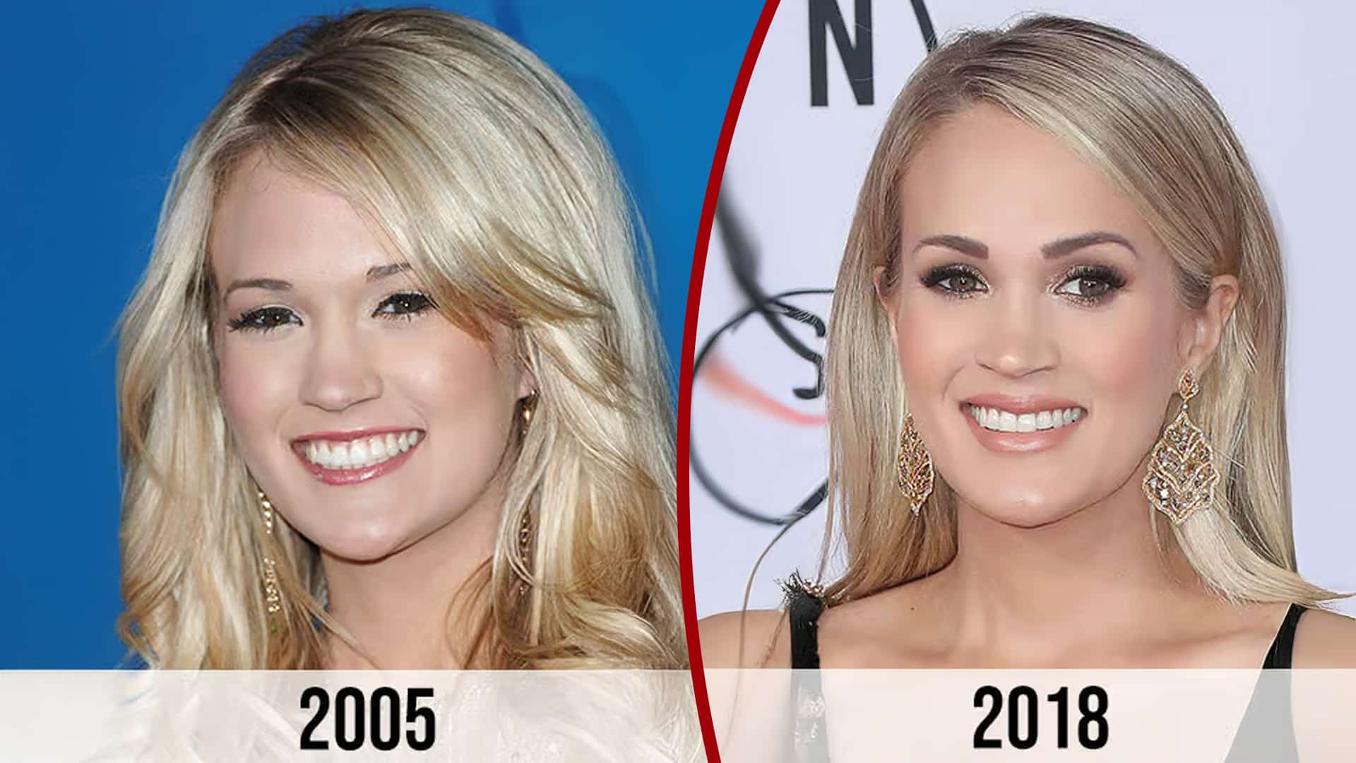 Carrie Underwood Plastic Surgery Face