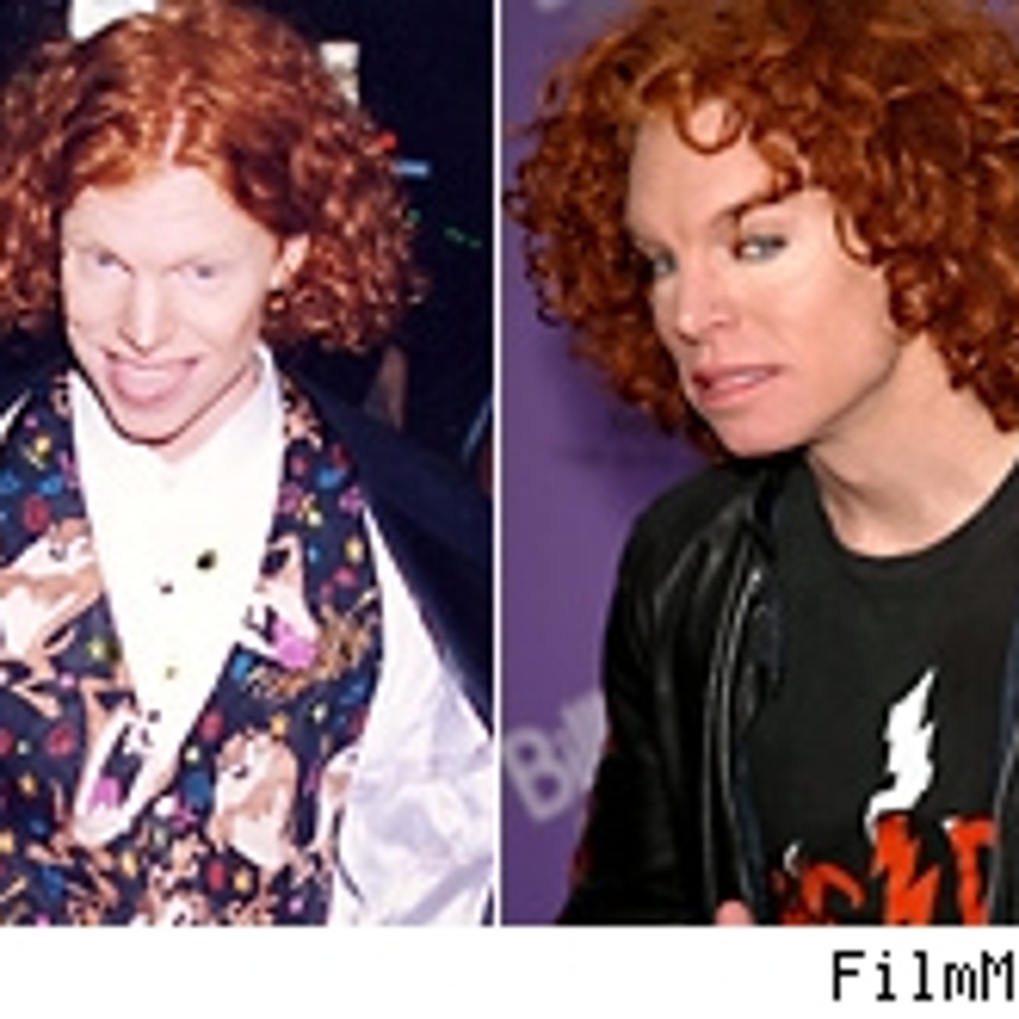Carrot Top Face Surgery