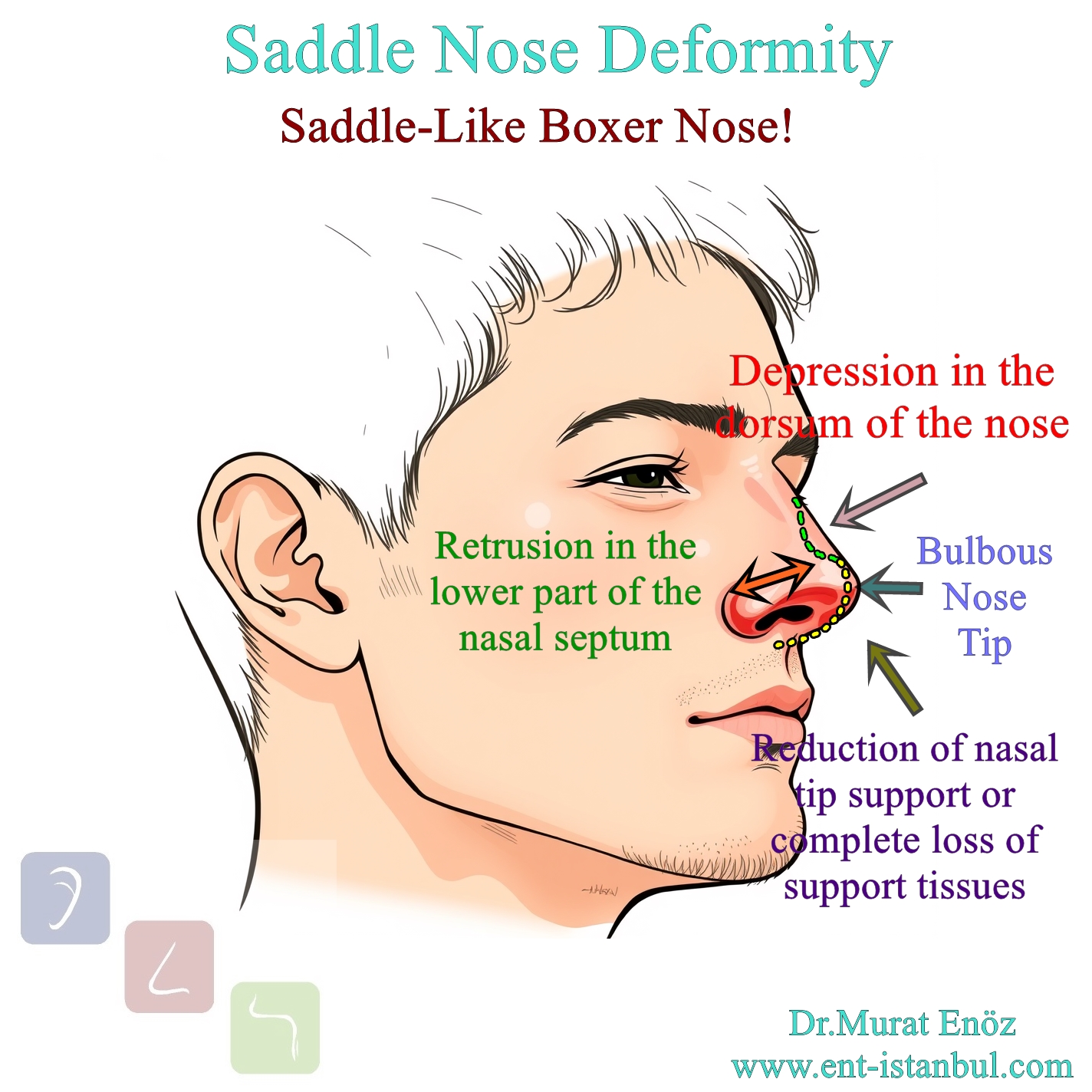 Celebrities That Have Nudes