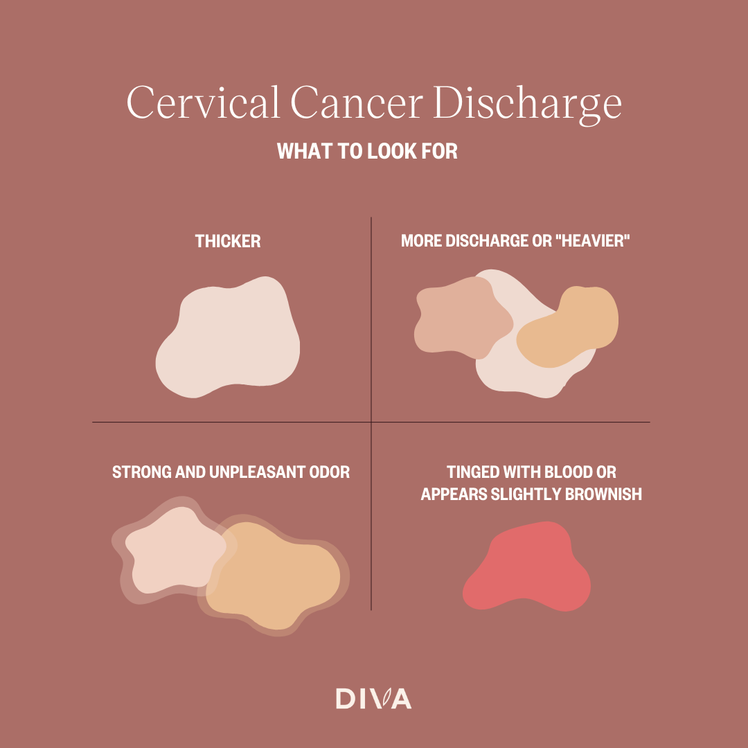 Cervical Cancer Discharge Pictures
