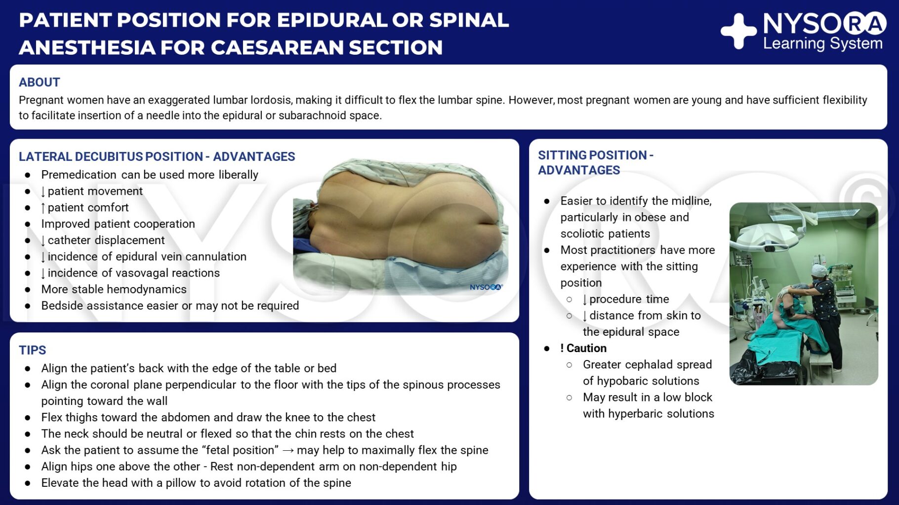 Cesarean Spinal Anesthesia