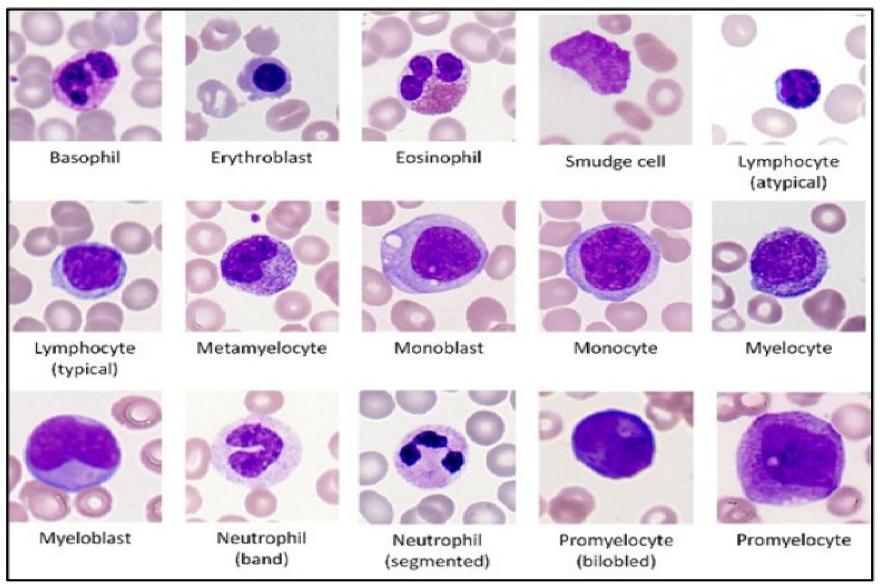 Characteristics Of White Blood Cells