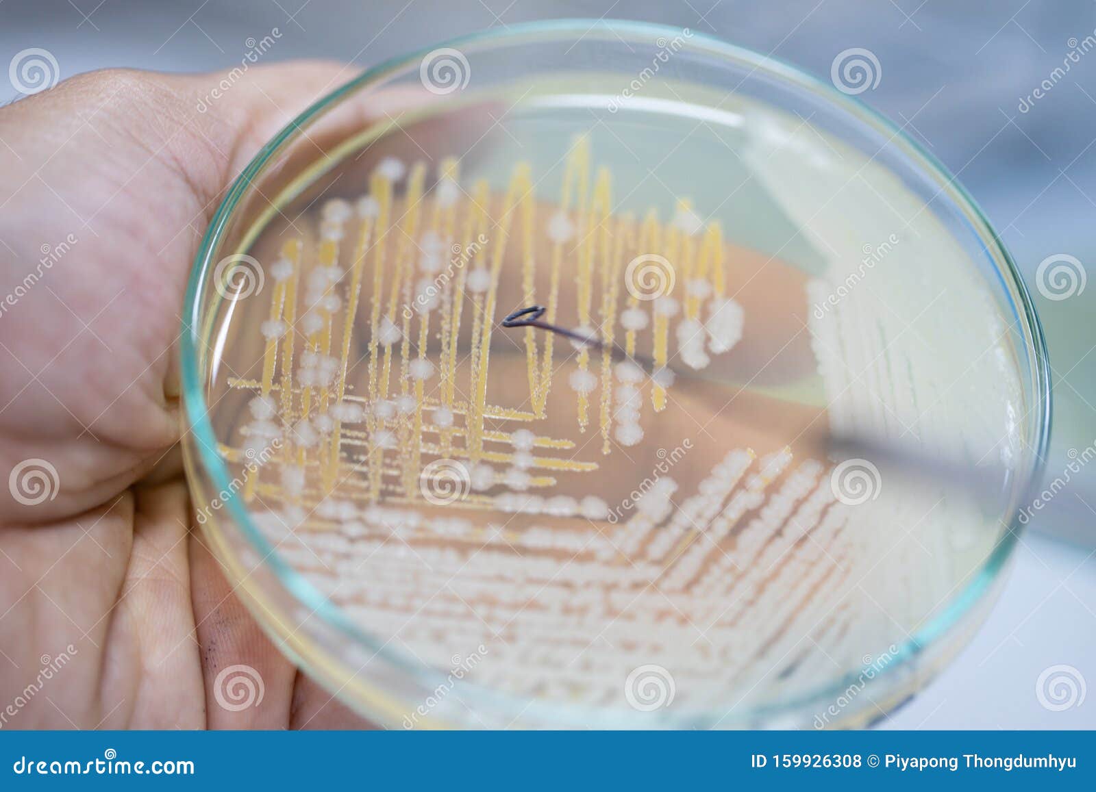 Characteristics Of Yeast