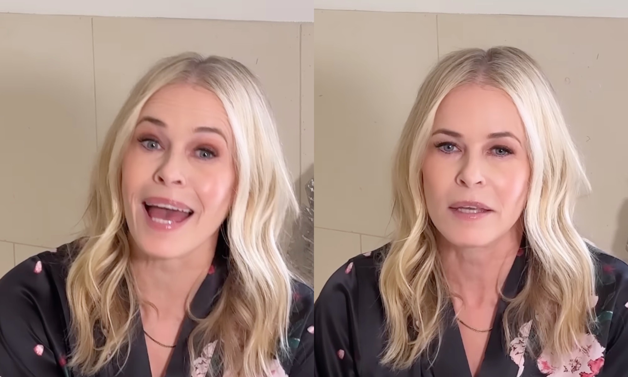 Chelsea Handler Face Surgery