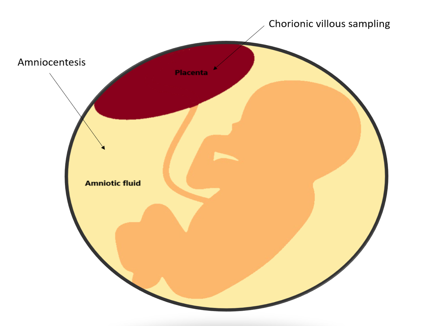 Chorionic Villus Sampling Paternity Test