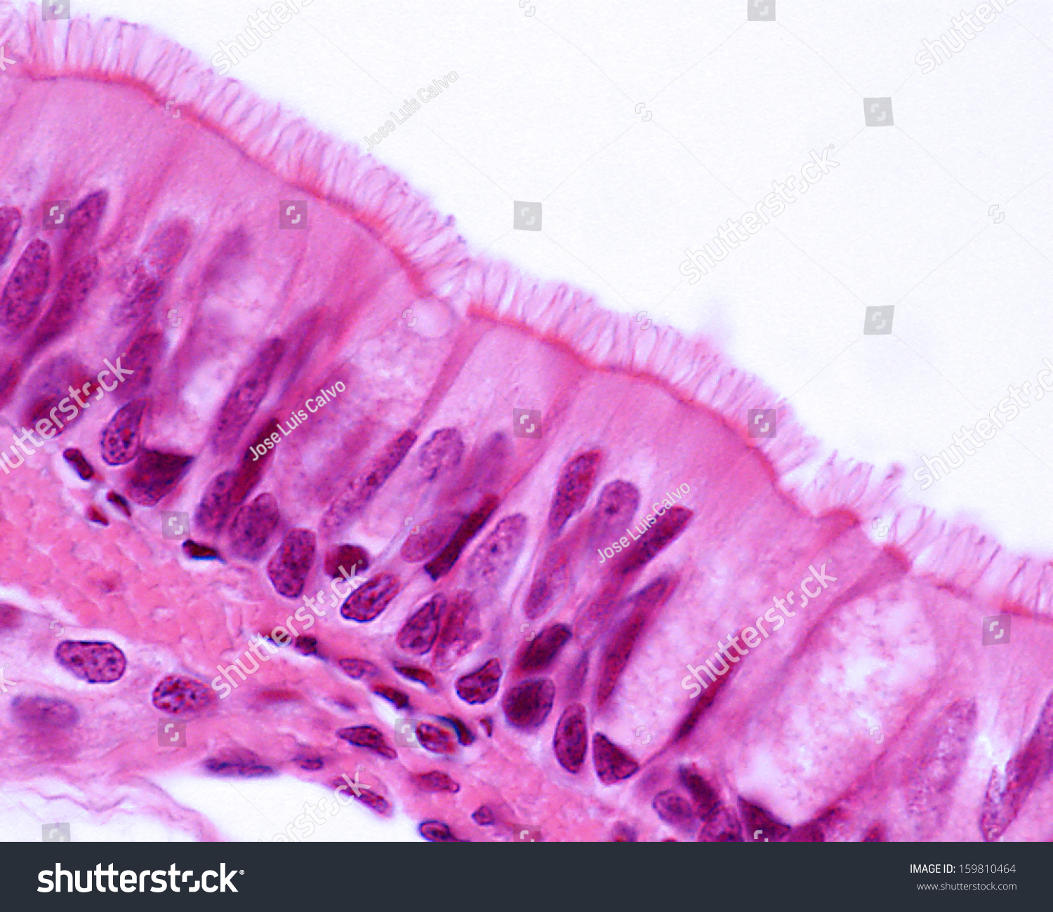 Ciliated Pseudostratified Columnar Epithelium
