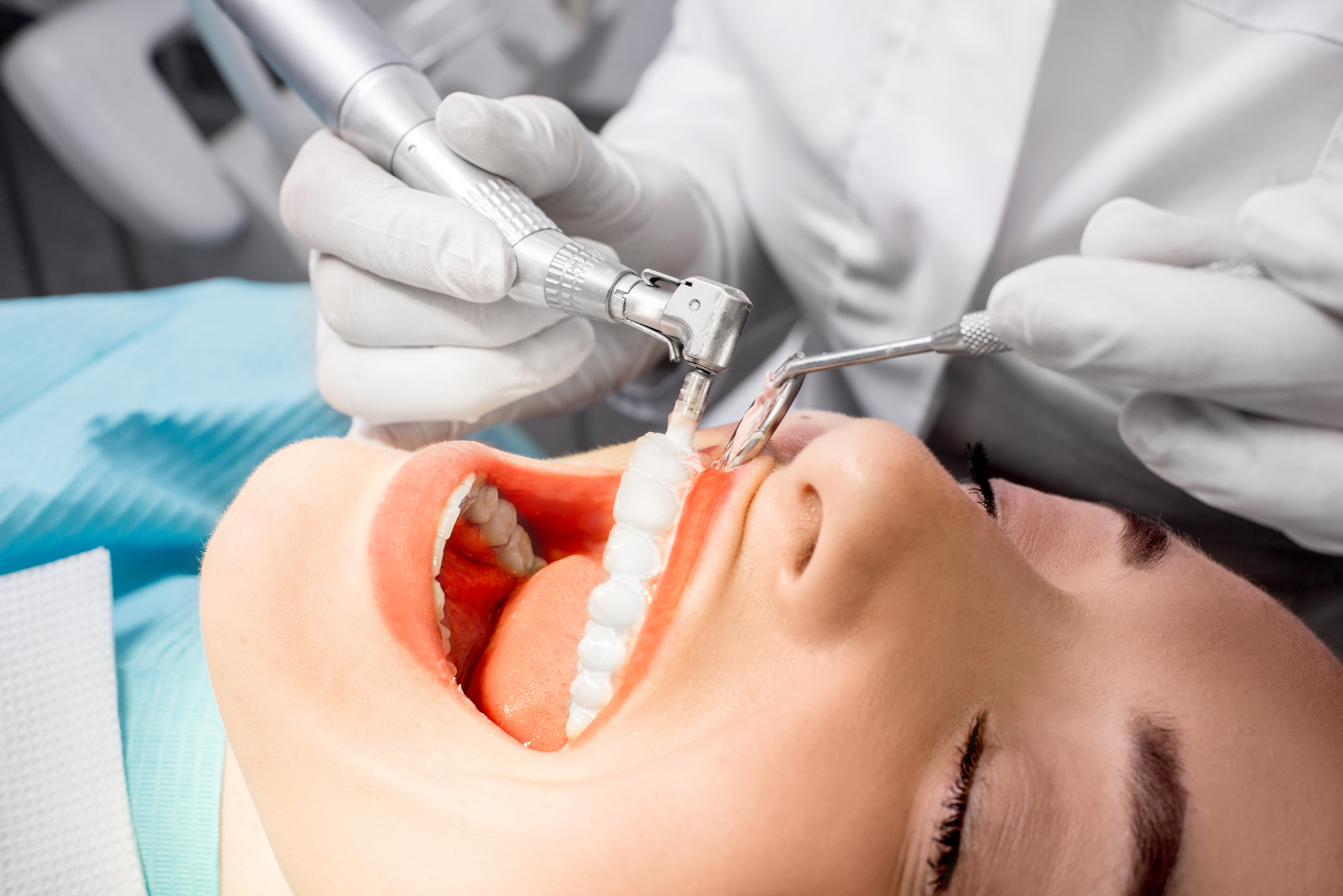 Cleaning Of Teeth At Dentist