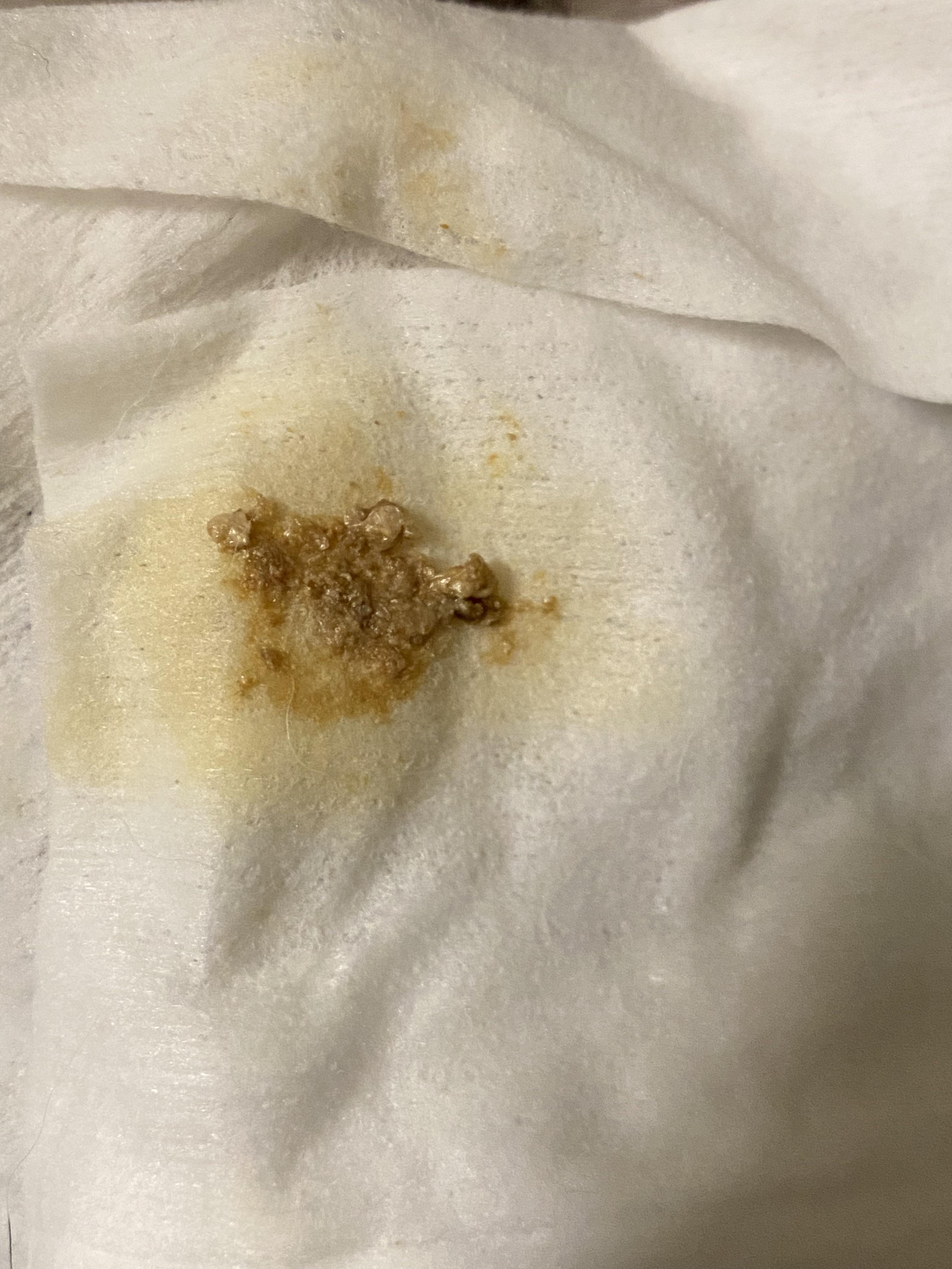 Clear Discharge From Anus