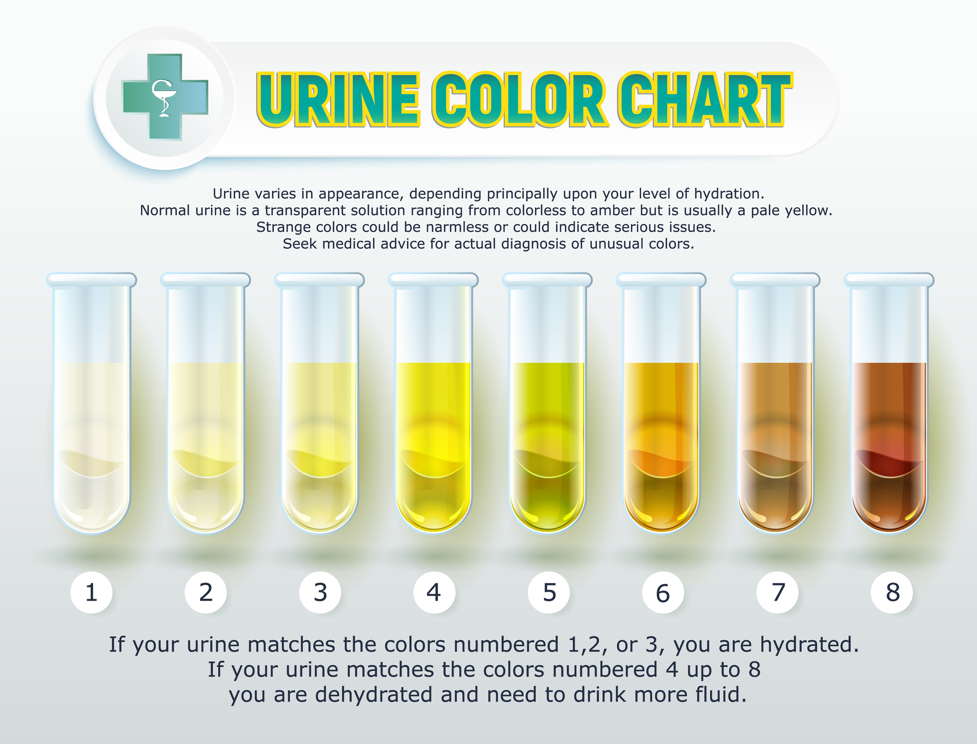 Color Of Urine Kidney Stones
