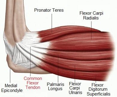 Common Flexor Tendon