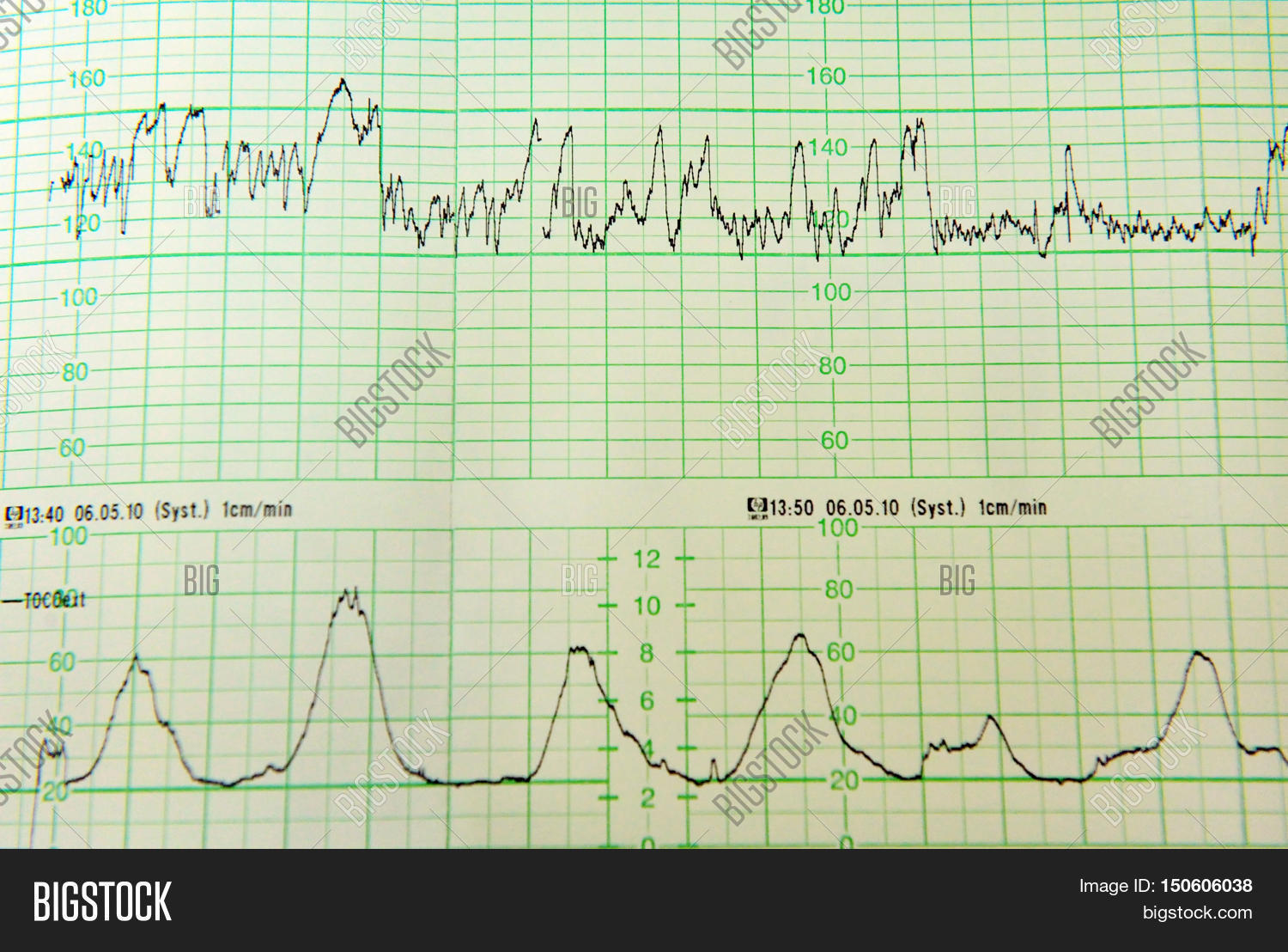 Contractions On Monitor