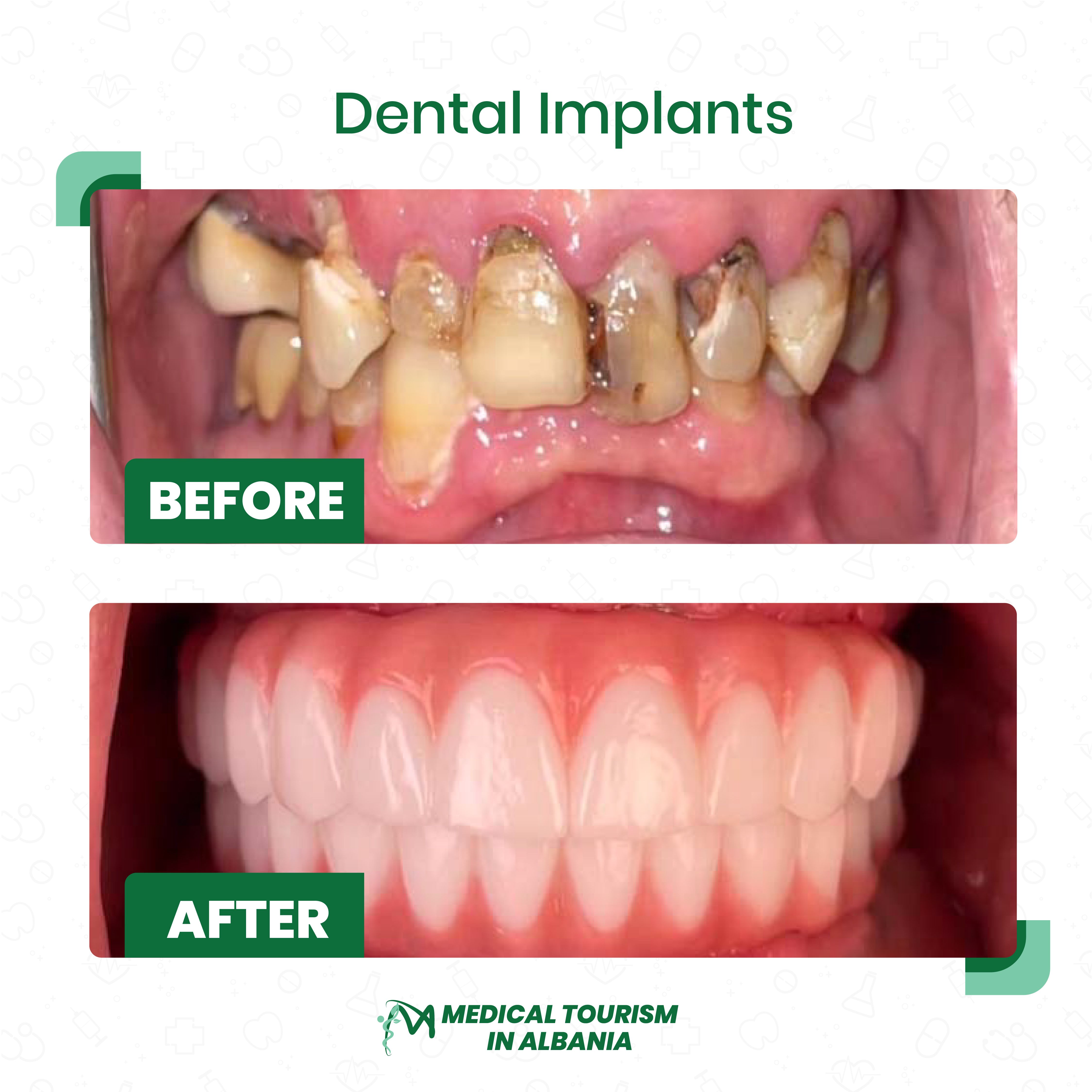 Cosmetic Dental Procedures